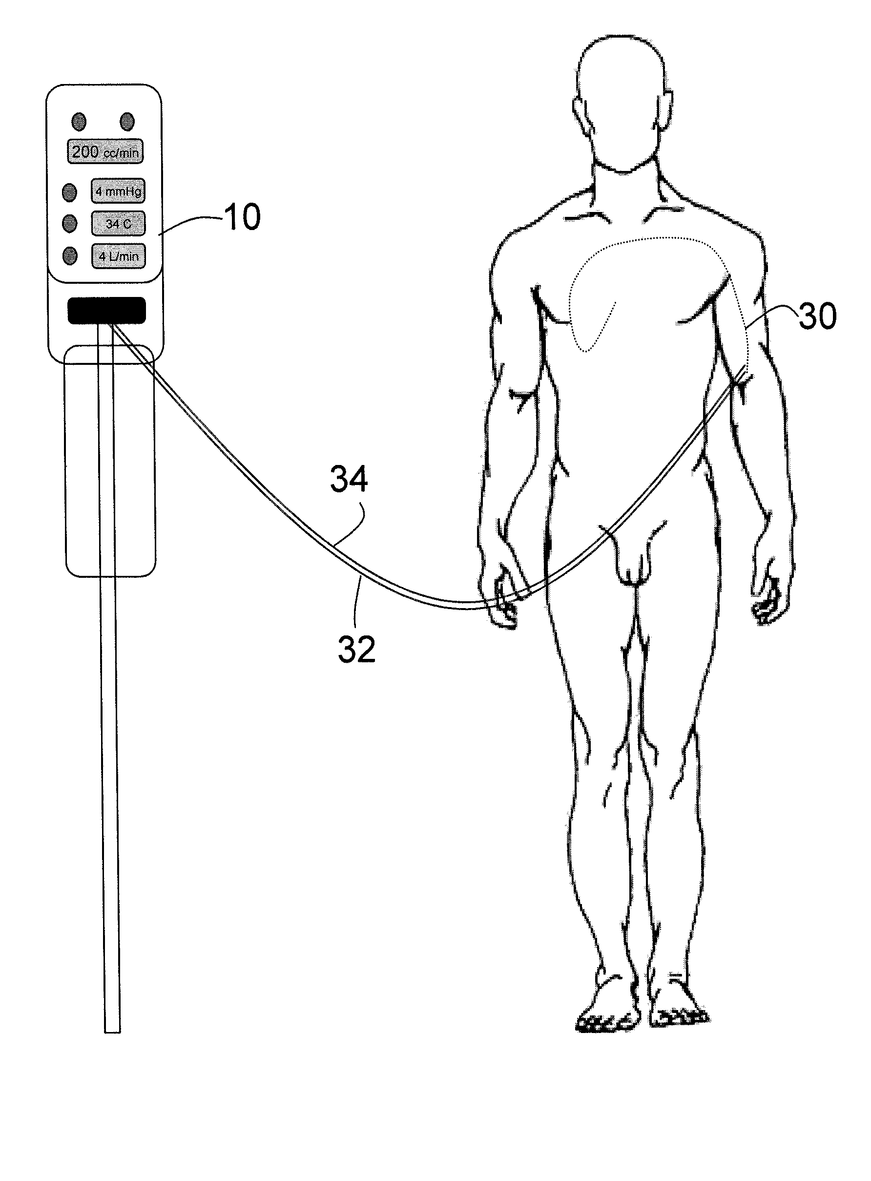 Automated therapy system and method