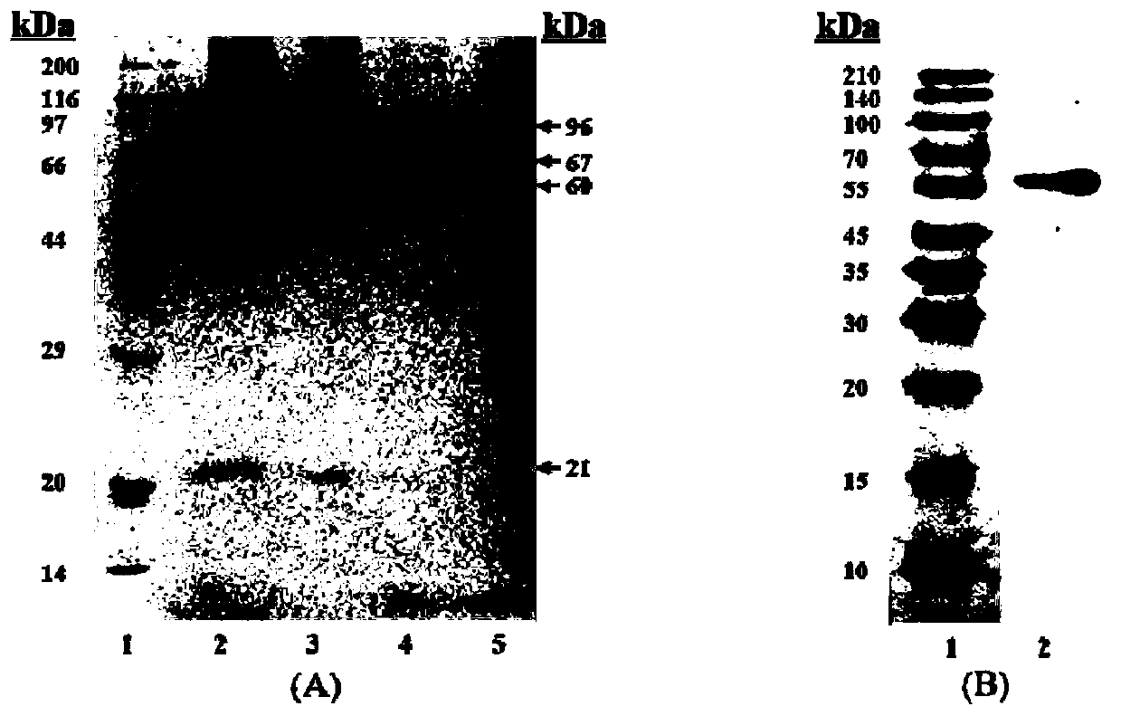 Method for detecting human soluble asialoglycoprotein receptor (sASGPR)