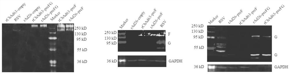 Replication-defective adenovirus vector vaccine for co-expressing respiratory syncytial virus pre-fusion protein and adhesion glycoprotein