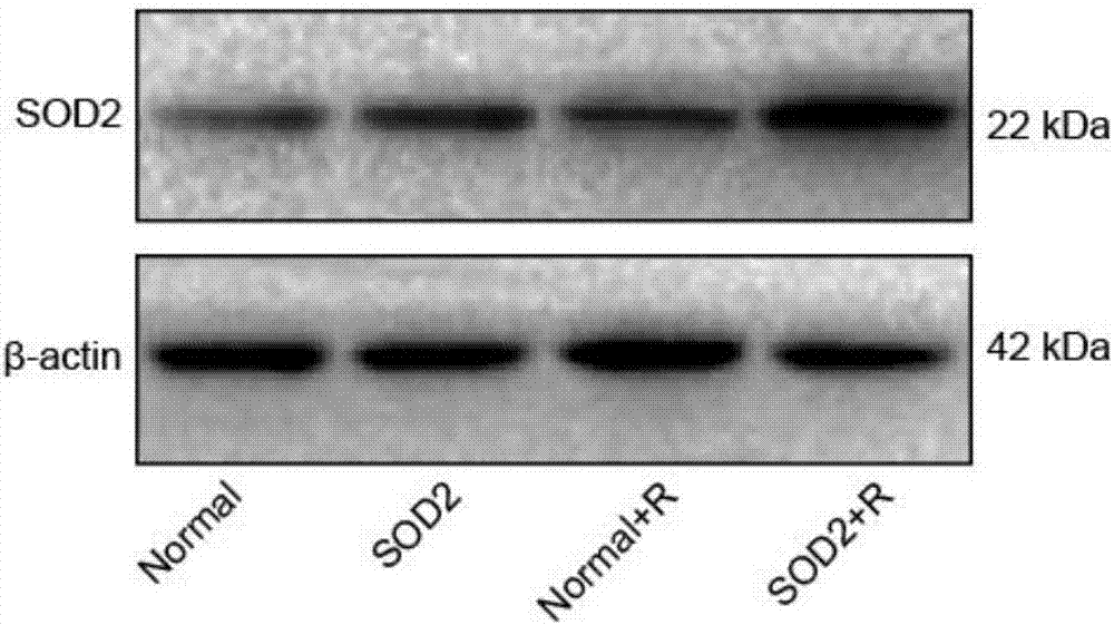 SOD2 lentiviral vector, construction method and application thereof in targeted radiation protection and tumor sensitization