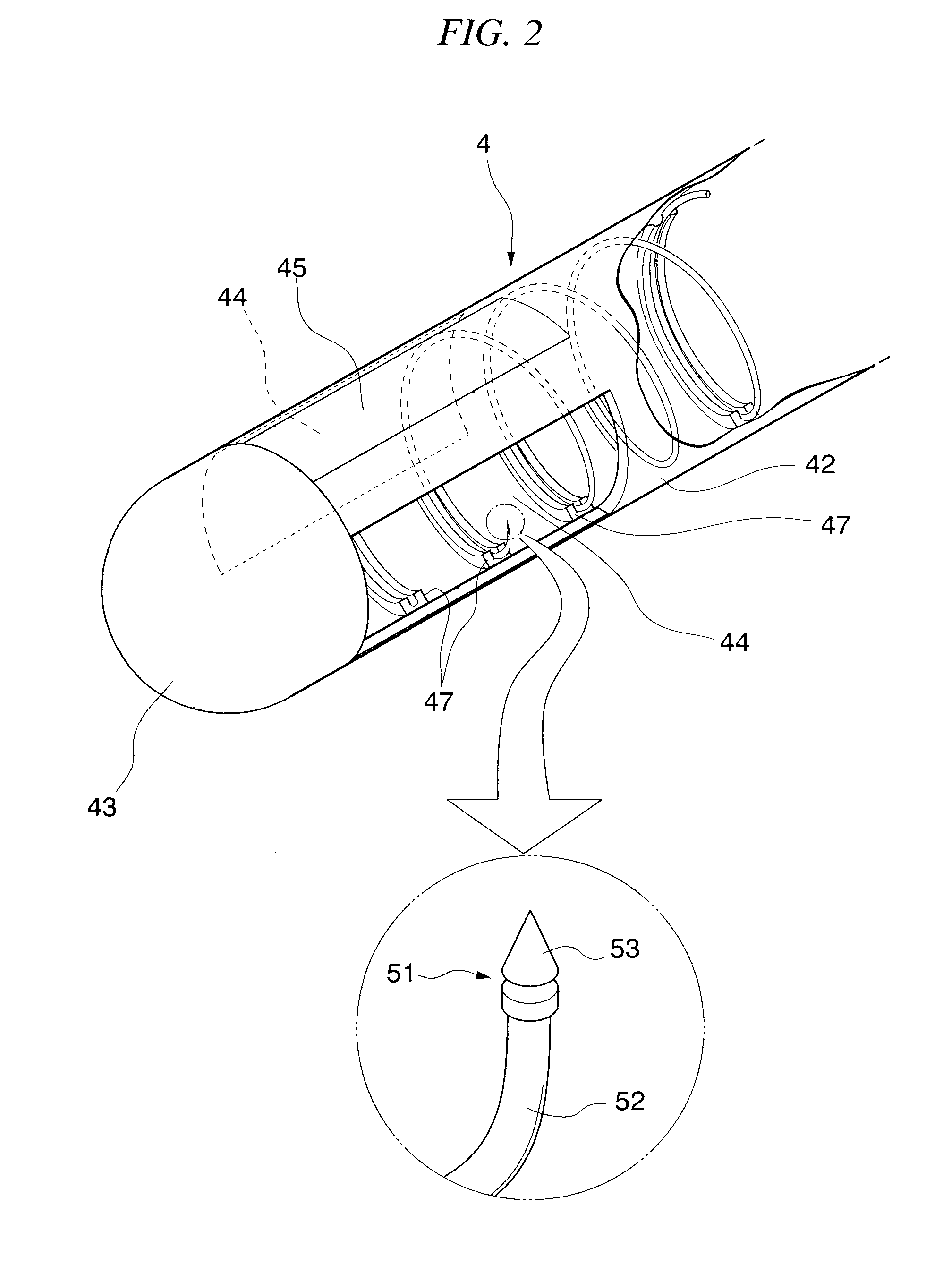 Gastric therapy system and method for suturing gastric wall