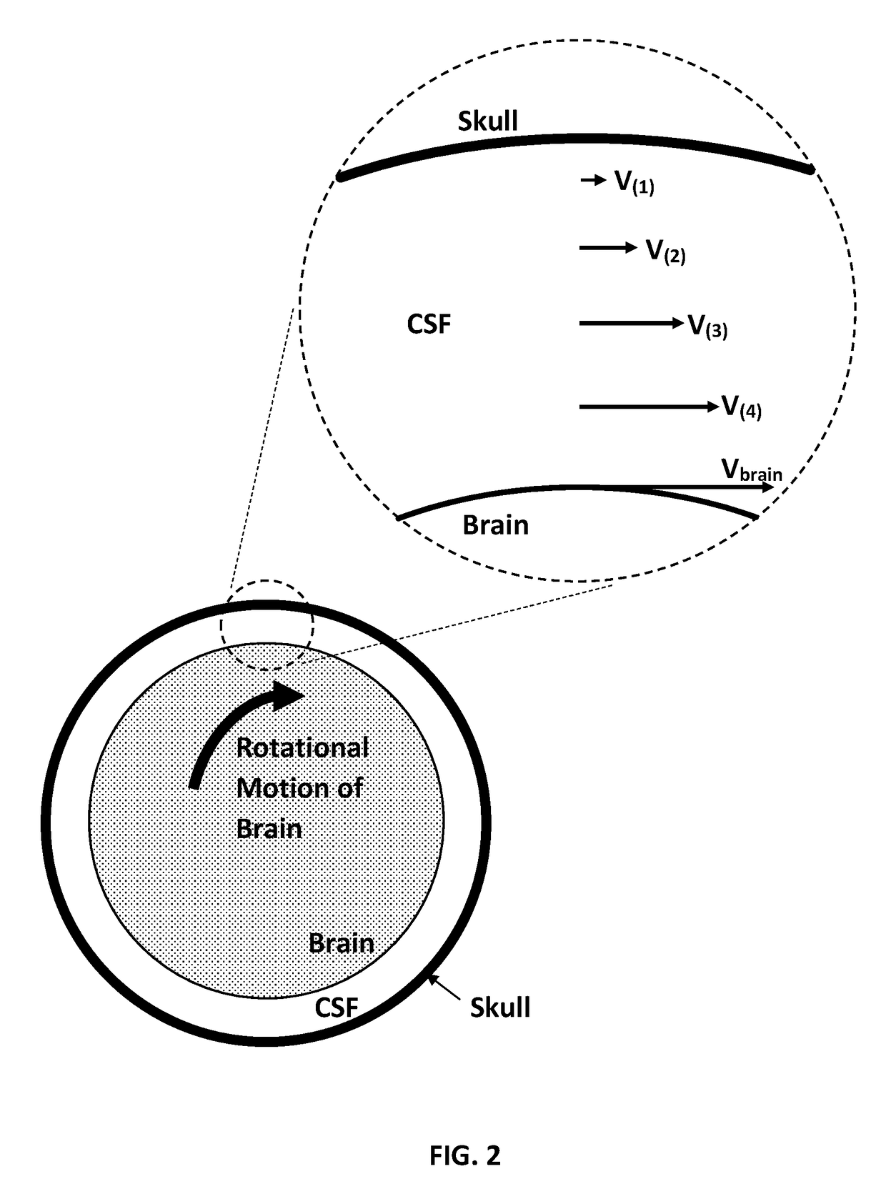 Method of Preventing Traumatic Brain Injury (TBI)