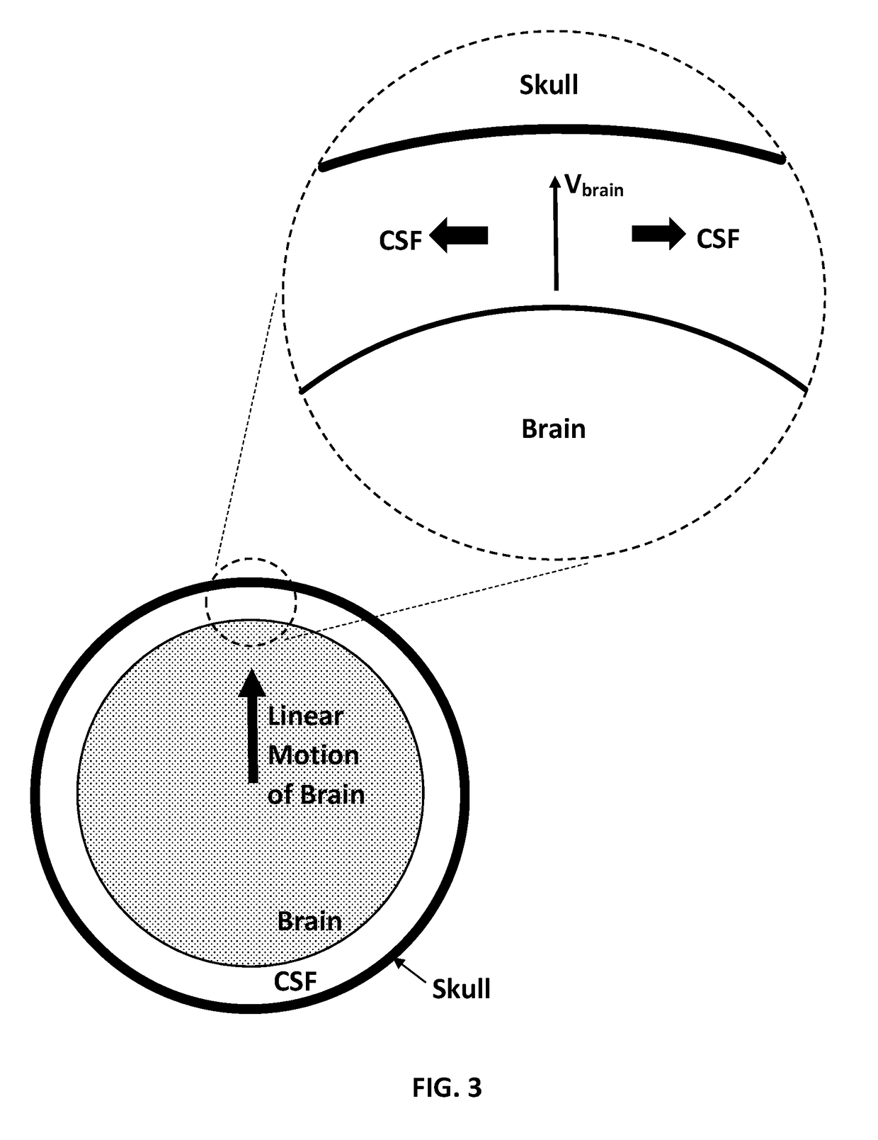 Method of Preventing Traumatic Brain Injury (TBI)