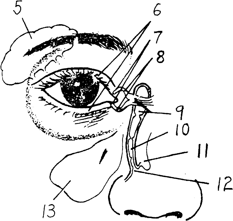 Application of biomedical fibrin glue serving as medicament for treating lacrimal duct obstruction diseases