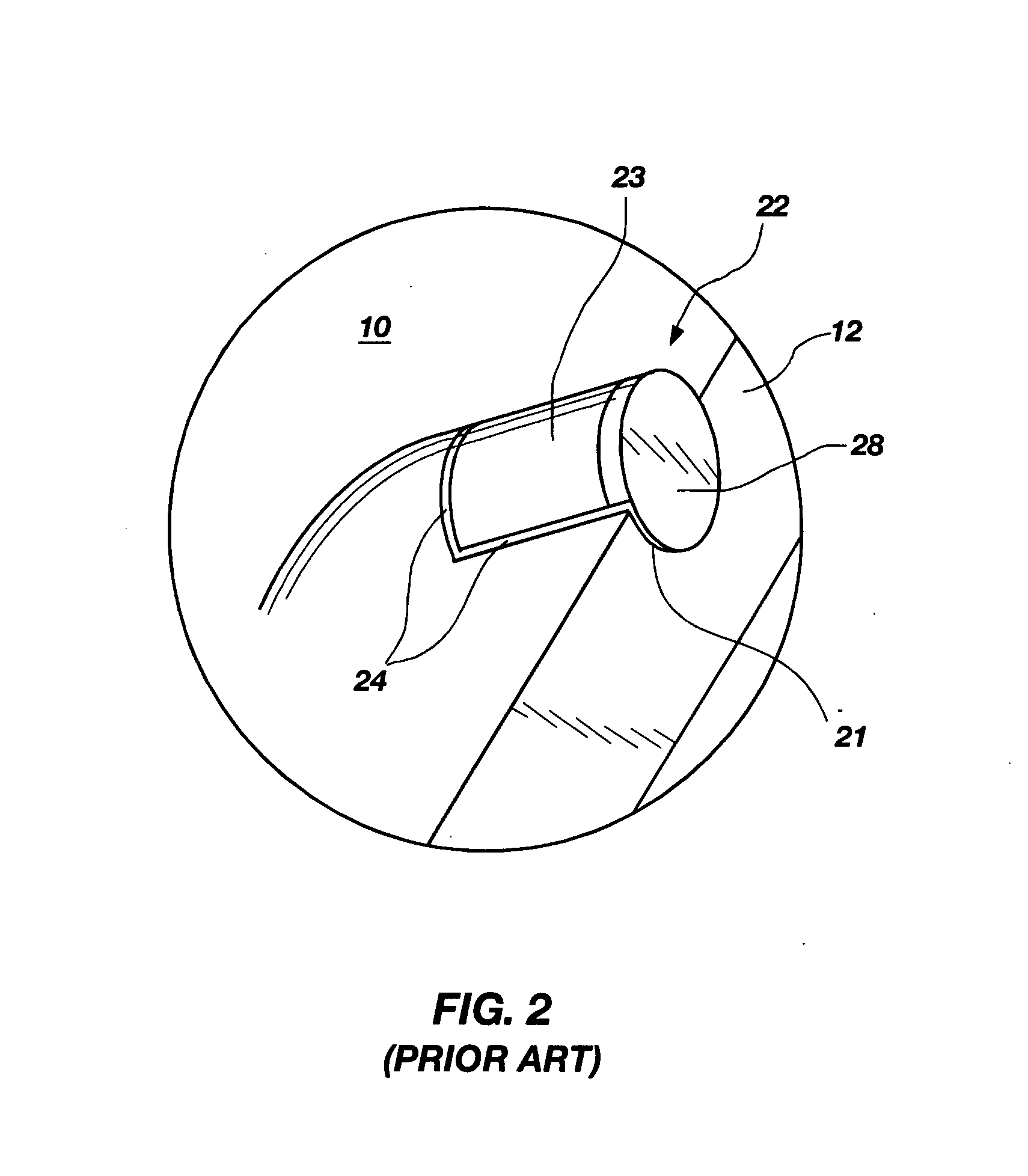 Particle-matrix composite drill bits with hardfacing and methods of manufacturing and repairing such drill bits using hardfacing materials