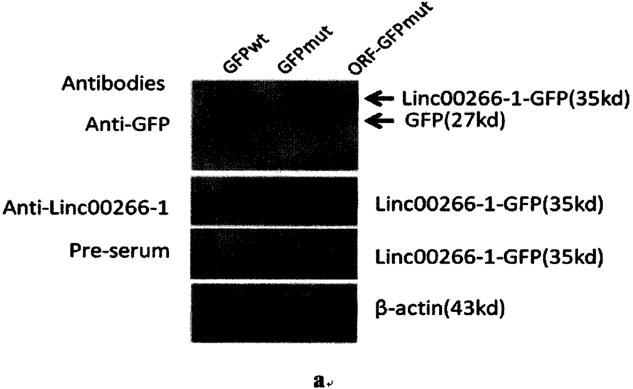Antibody capable of bonding with LINC0266-1