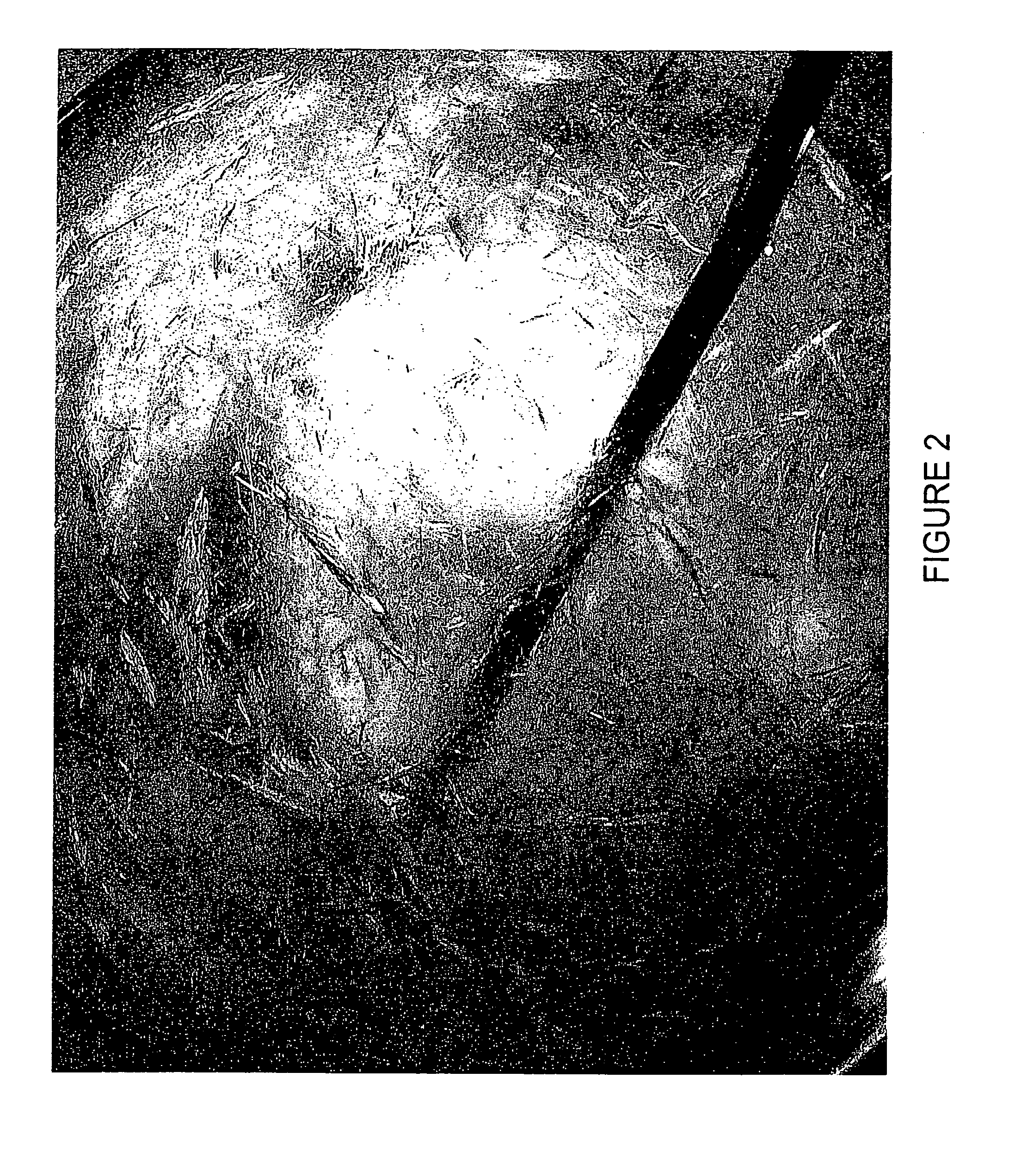 Method for inducing hypothermia