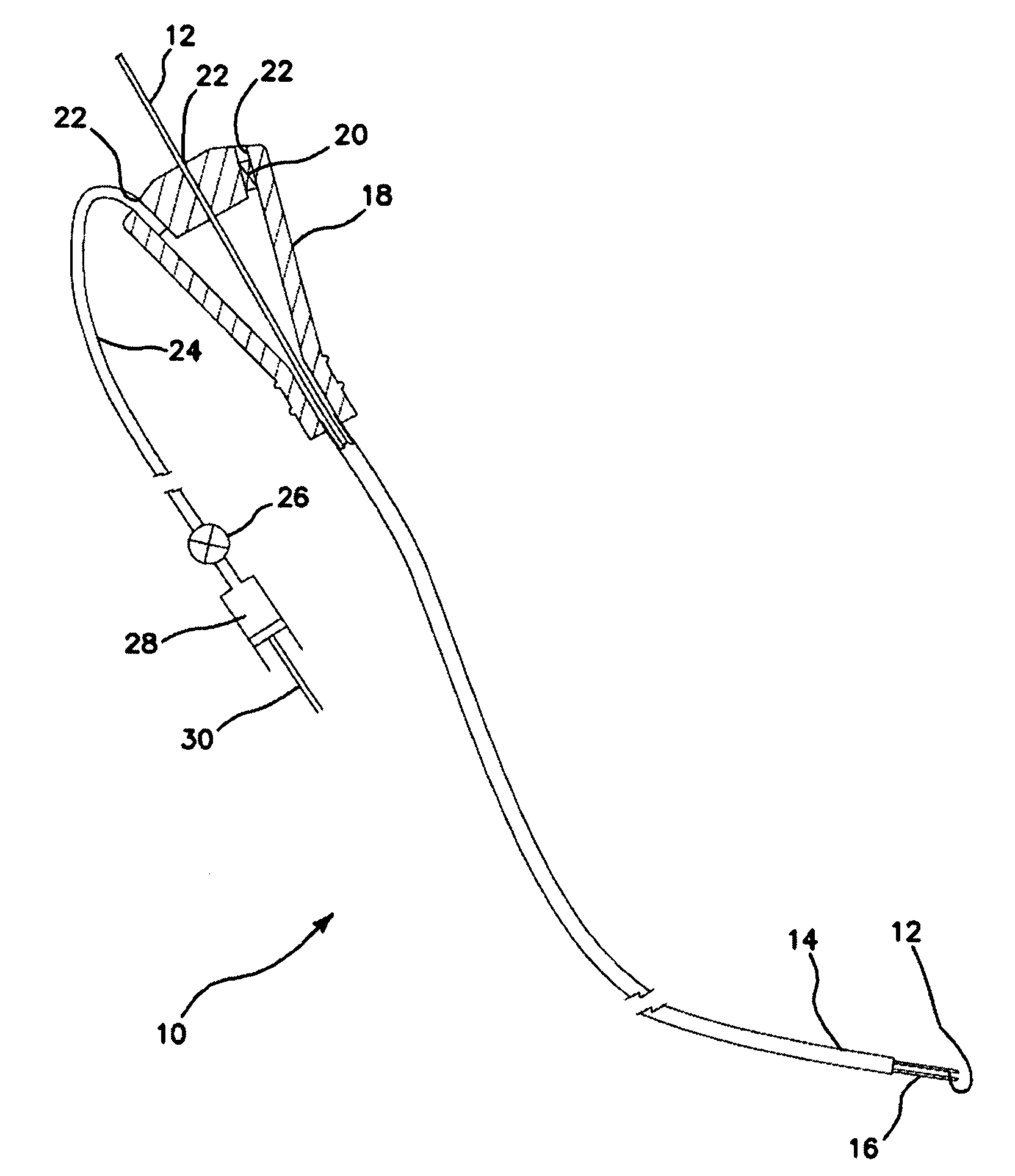 Balloon catheter and method of manufacture of the same