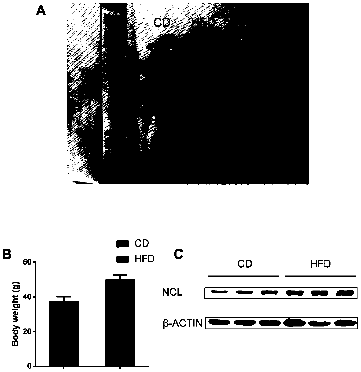 Application of nucleolin in preparation of drugs for improving glucose metabolism disorders
