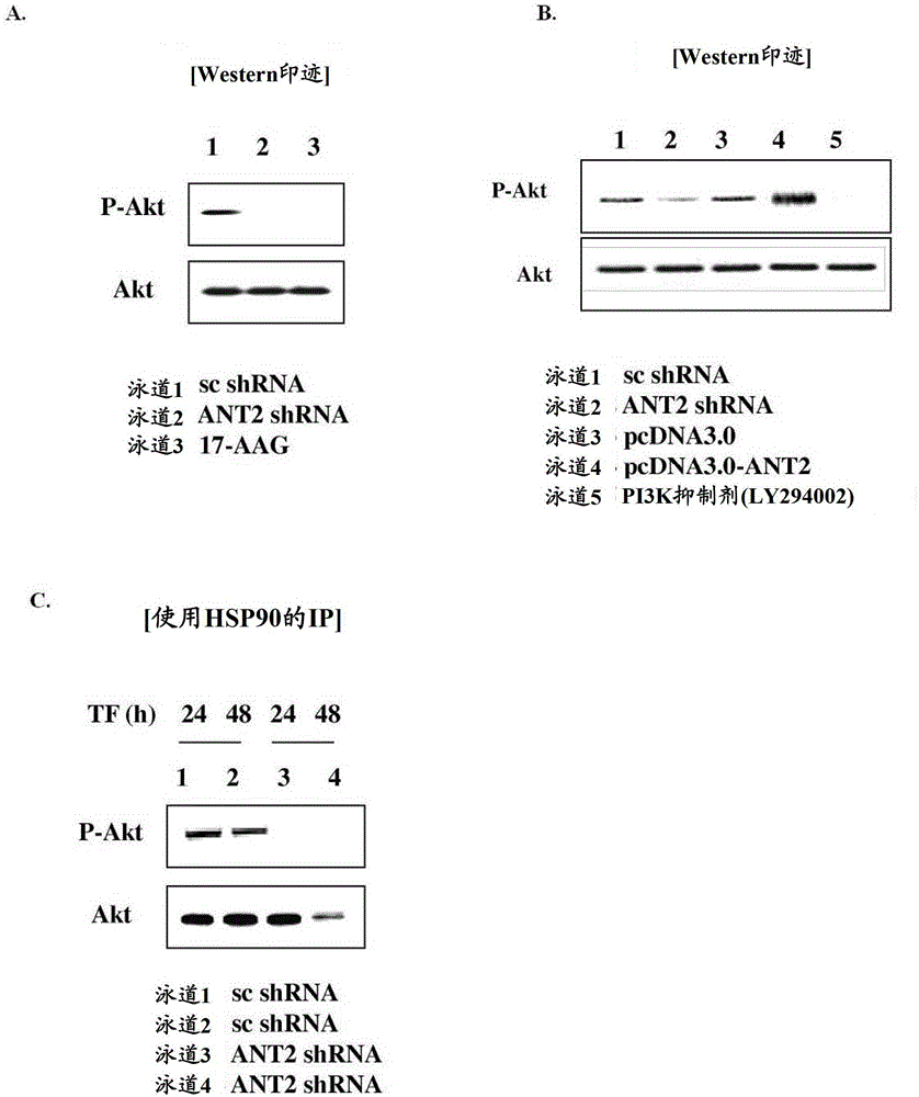 Method for treating breast cancer by reducing expression of adenine nucleotide transporter 2 mRNA