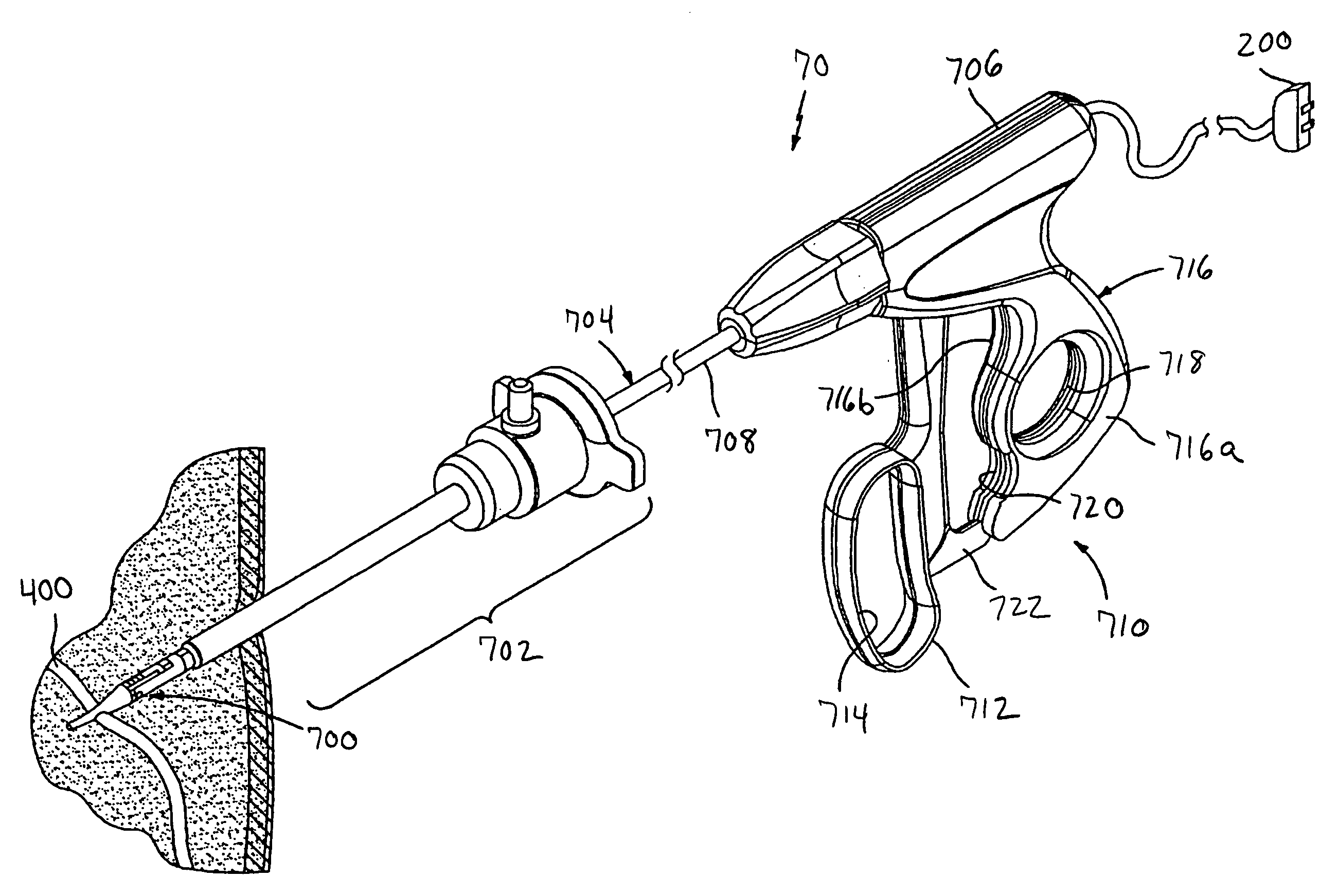 Vessel sealing system using capacitive RF dielectric heating