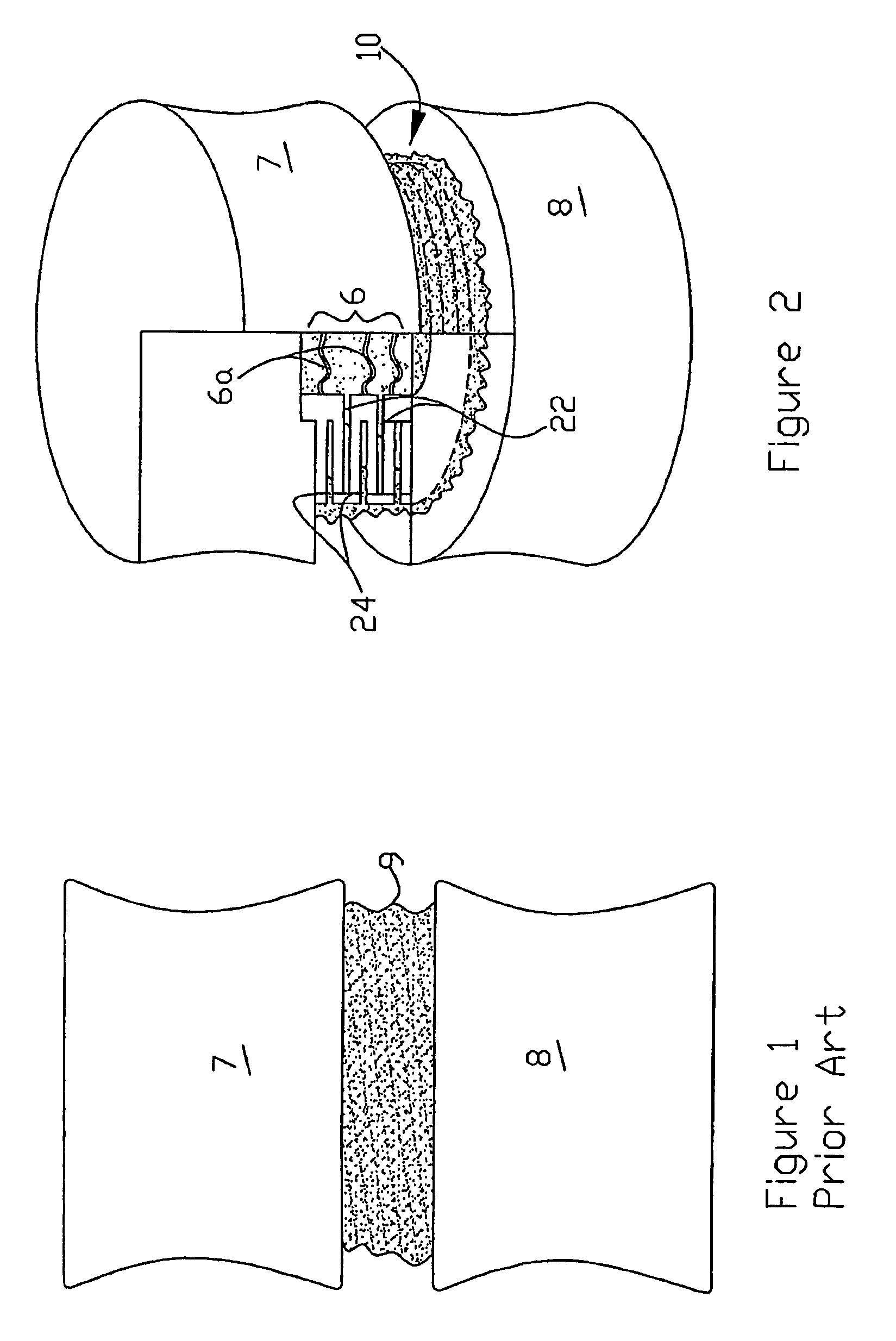 Intervertebral prosthesis for supporting adjacent vertebral bodies enabling the creation of soft fusion and method