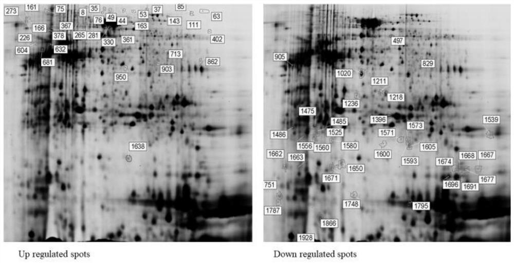 Marker for predicting response of cancer patient to chemotherapy and application thereof