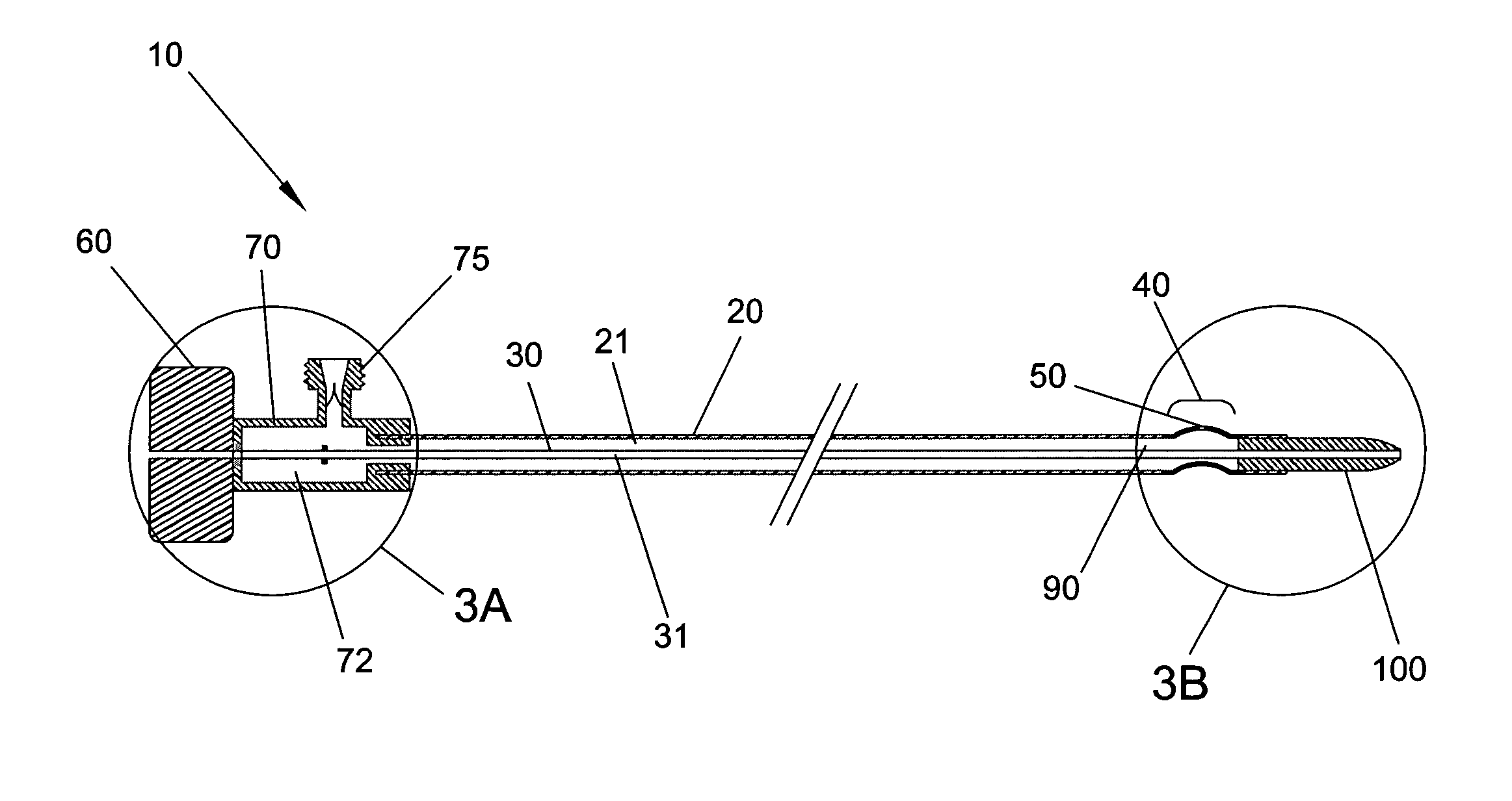 Material removal catheter and method