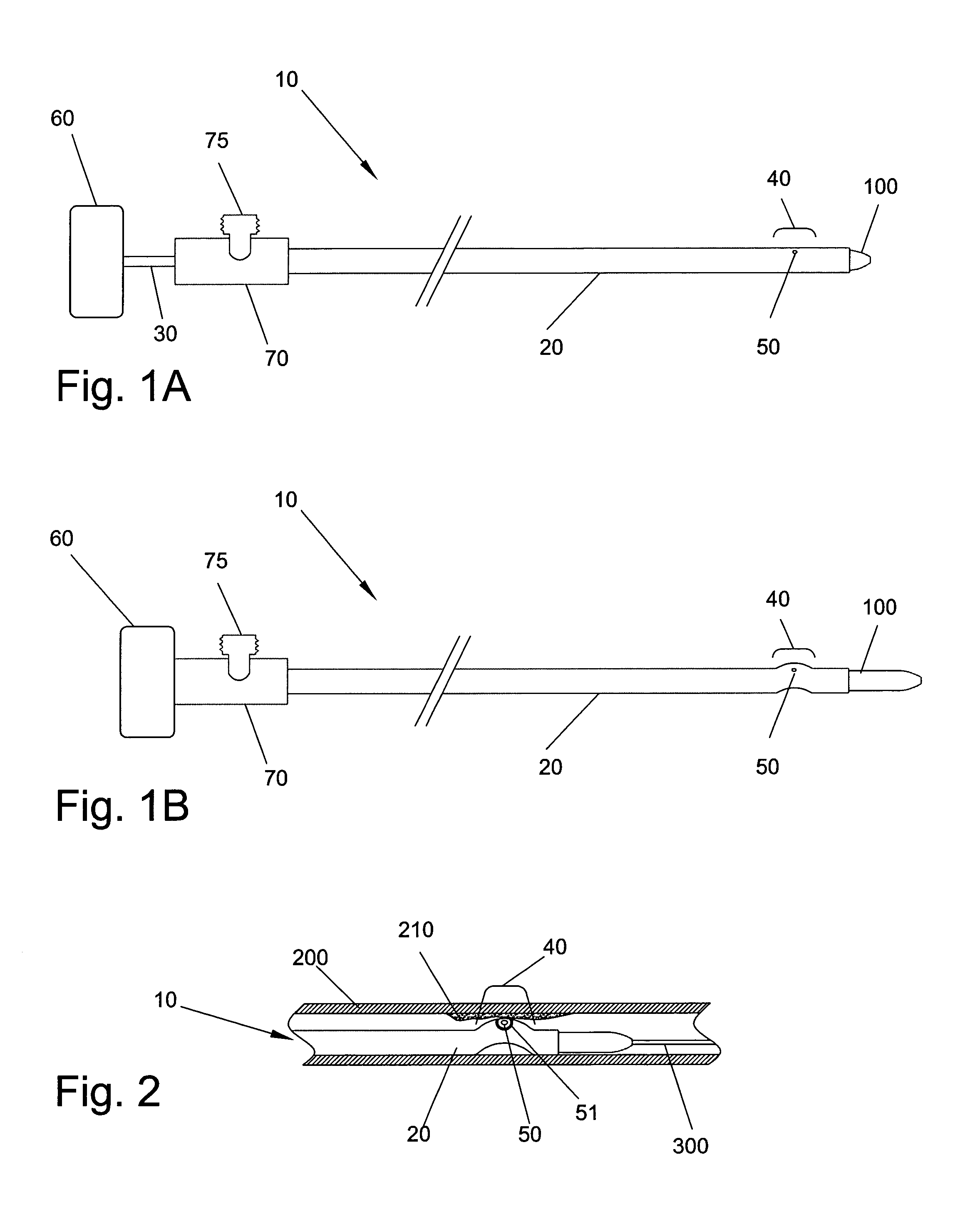 Material removal catheter and method