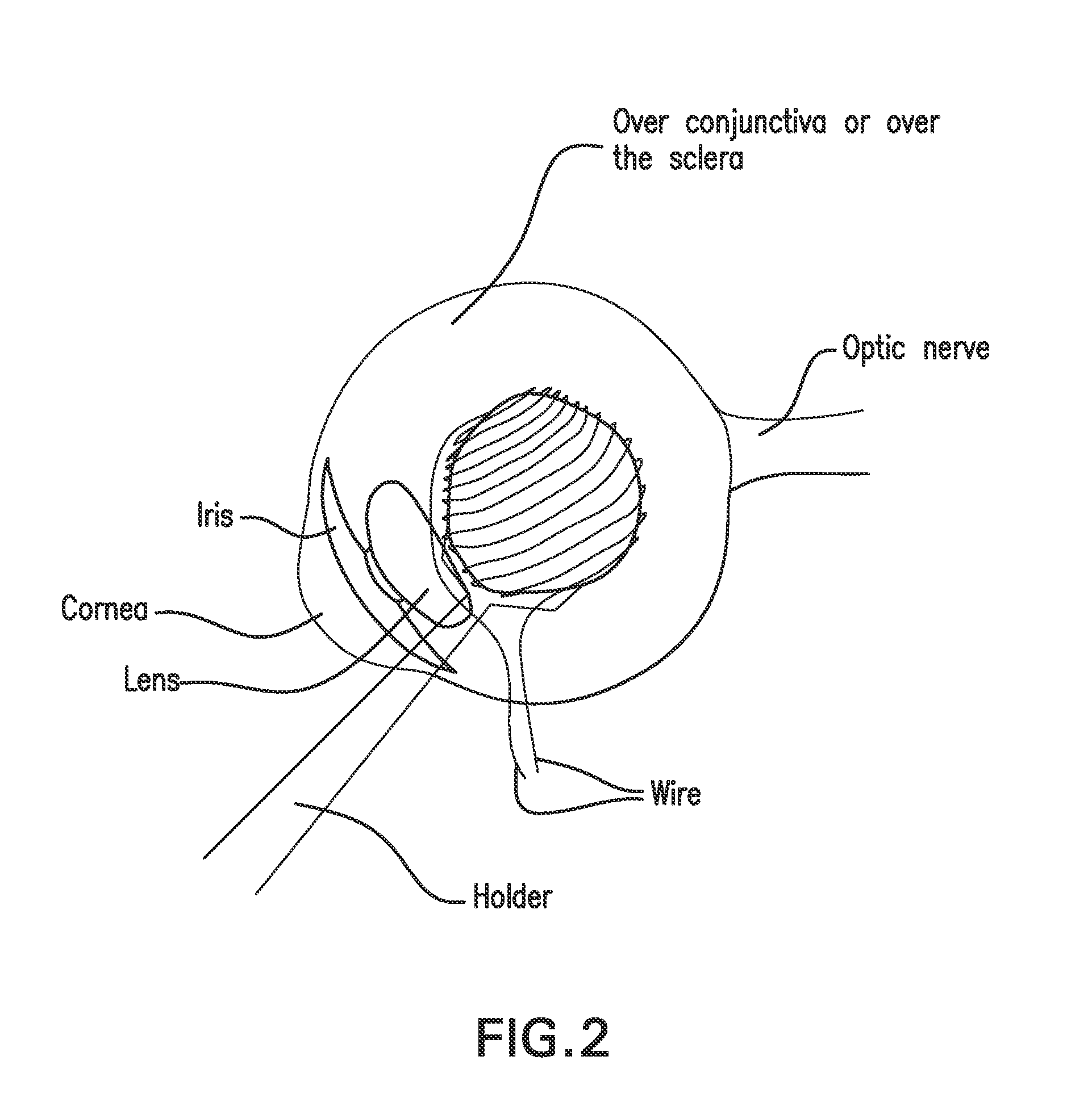 Method and composition for hyperthermally treating cells