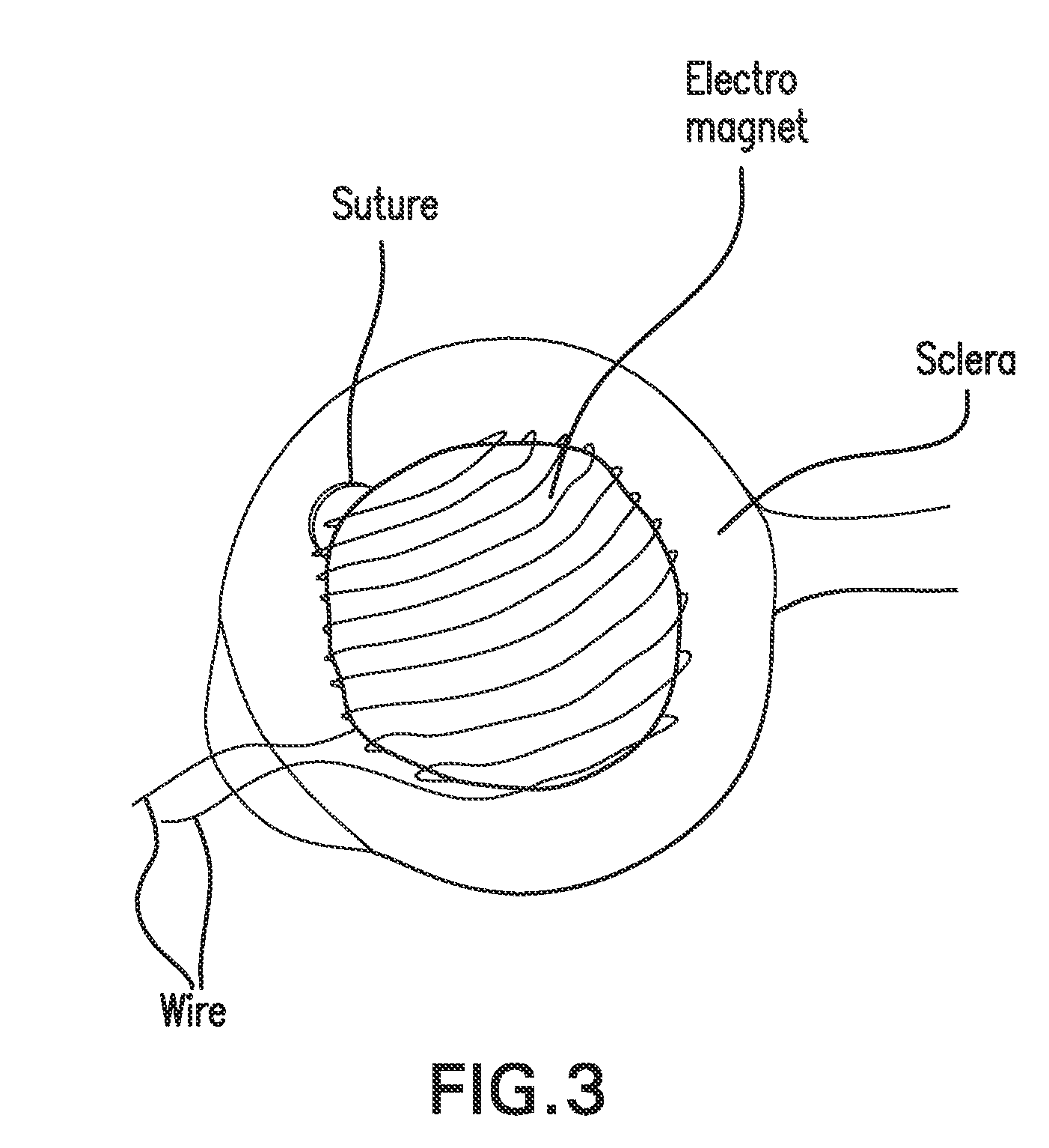 Method and composition for hyperthermally treating cells