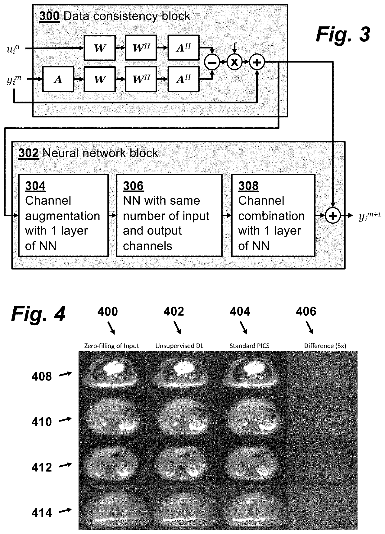 Method for Performing Magnetic Resonance Imaging Reconstruction with Unsupervised Deep Learning