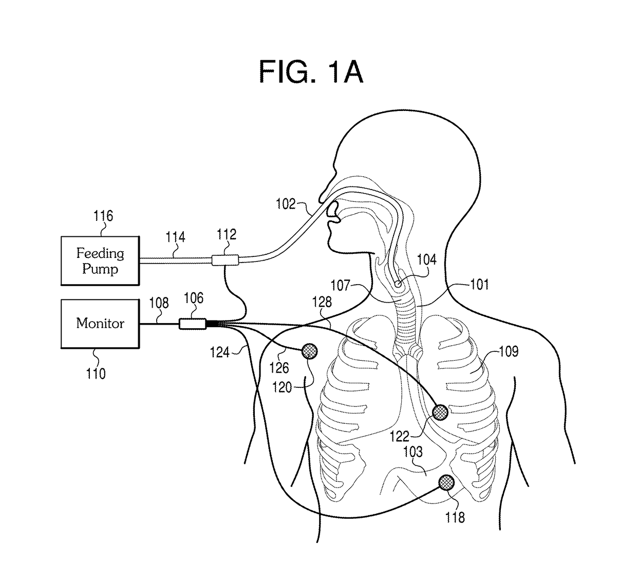 Methods and apparatus for guiding medical care based on sensor data from the gastrointestinal tract