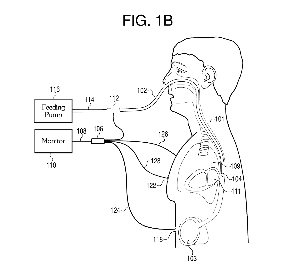 Methods and apparatus for guiding medical care based on sensor data from the gastrointestinal tract