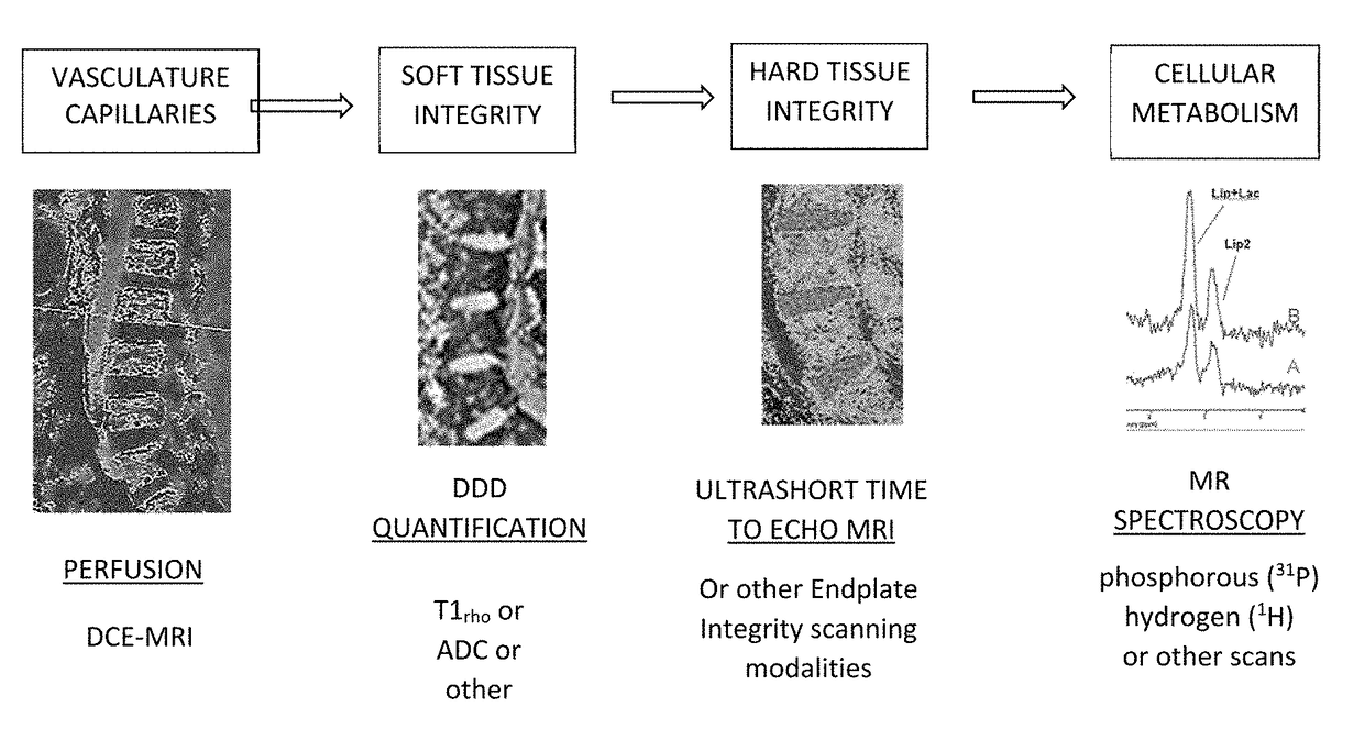 Therapeutic angiogenesis for treating erectile conditions