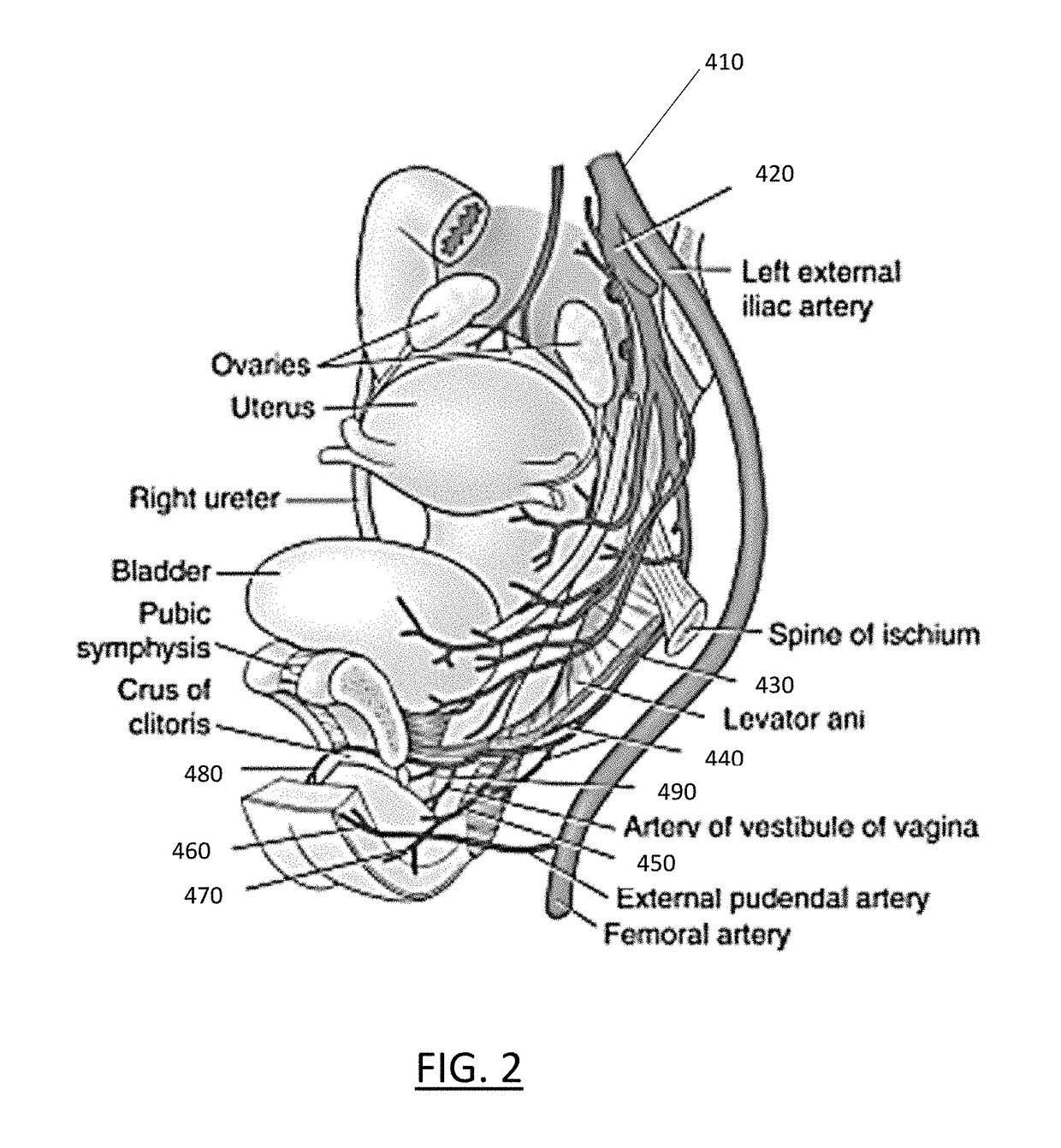 Therapeutic angiogenesis for treating erectile conditions