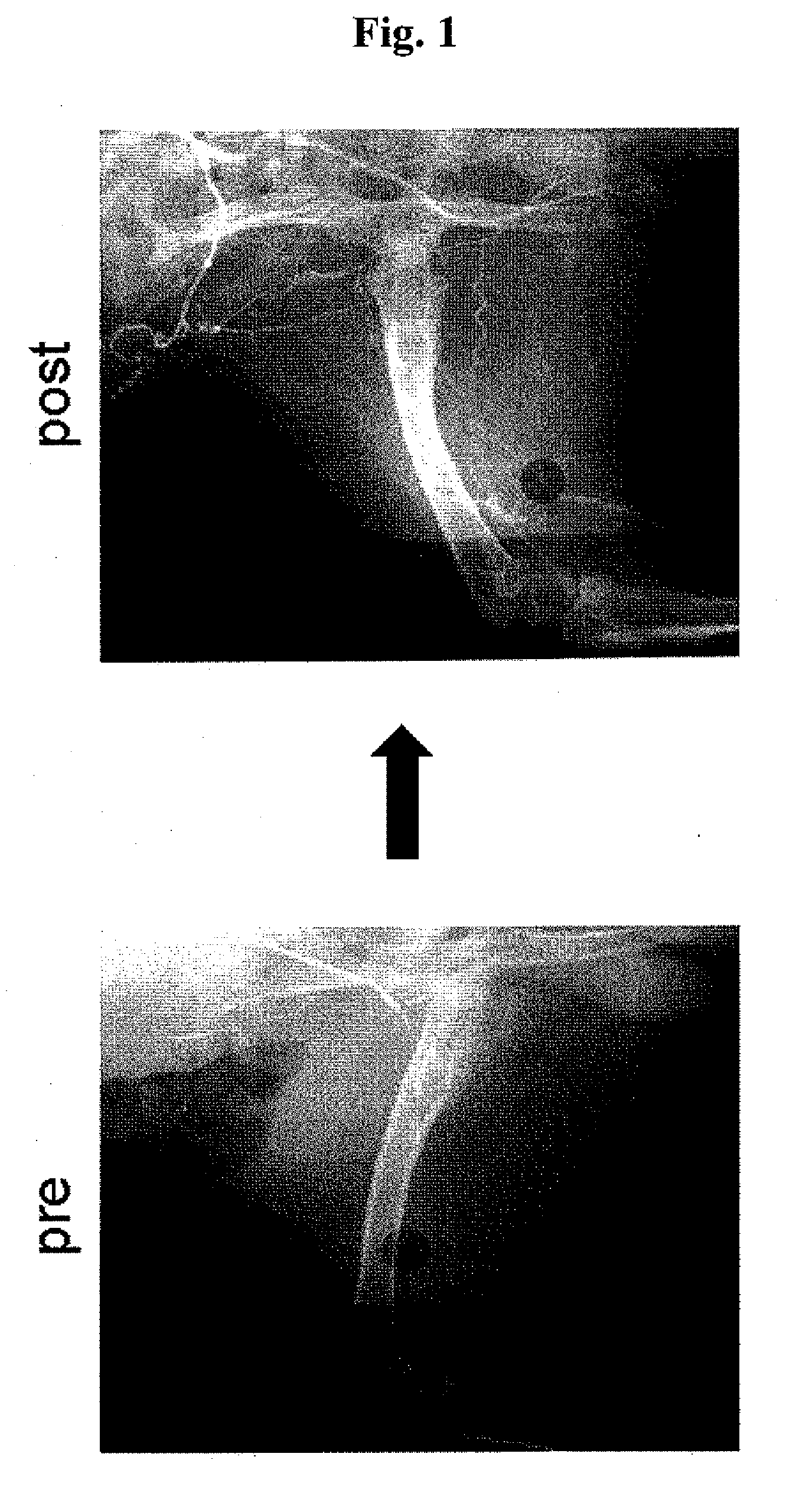 Ischemia therapeutic agent