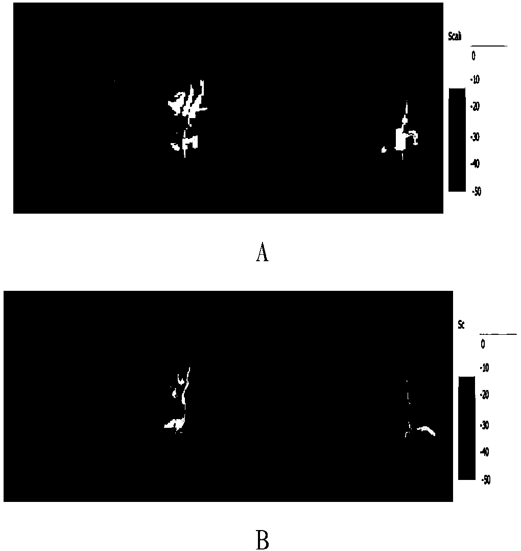 EEG analysis system used in electromagnetic radiation environment