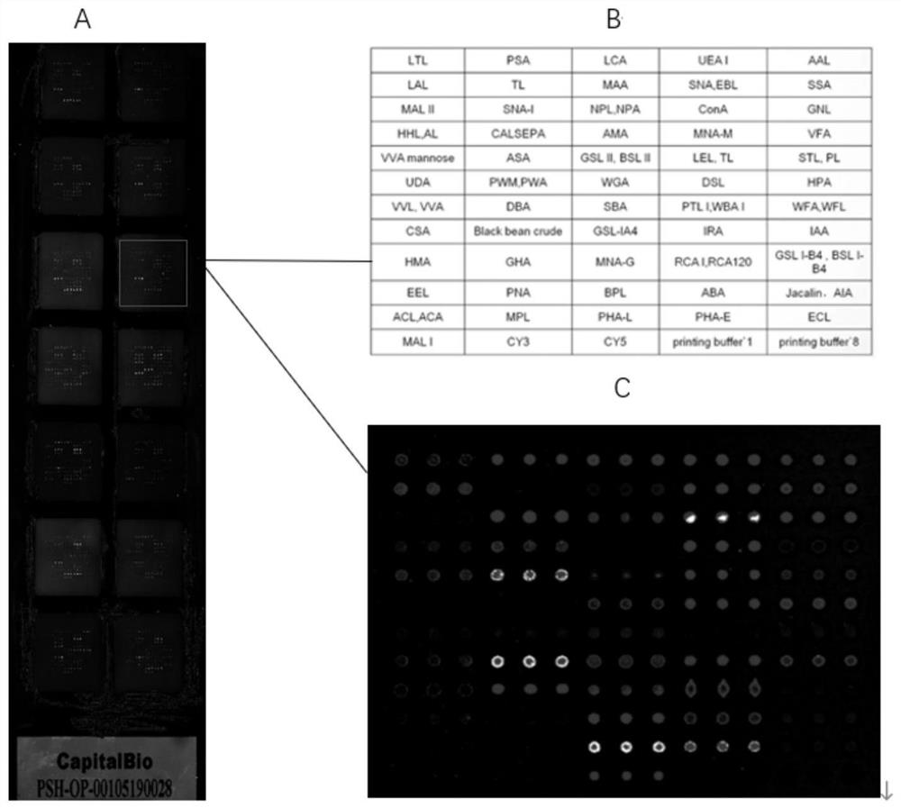 Sugar chain marker for diagnosing PBC patients with positive and negative anti-ACA antibodies and application of sugar chain marker