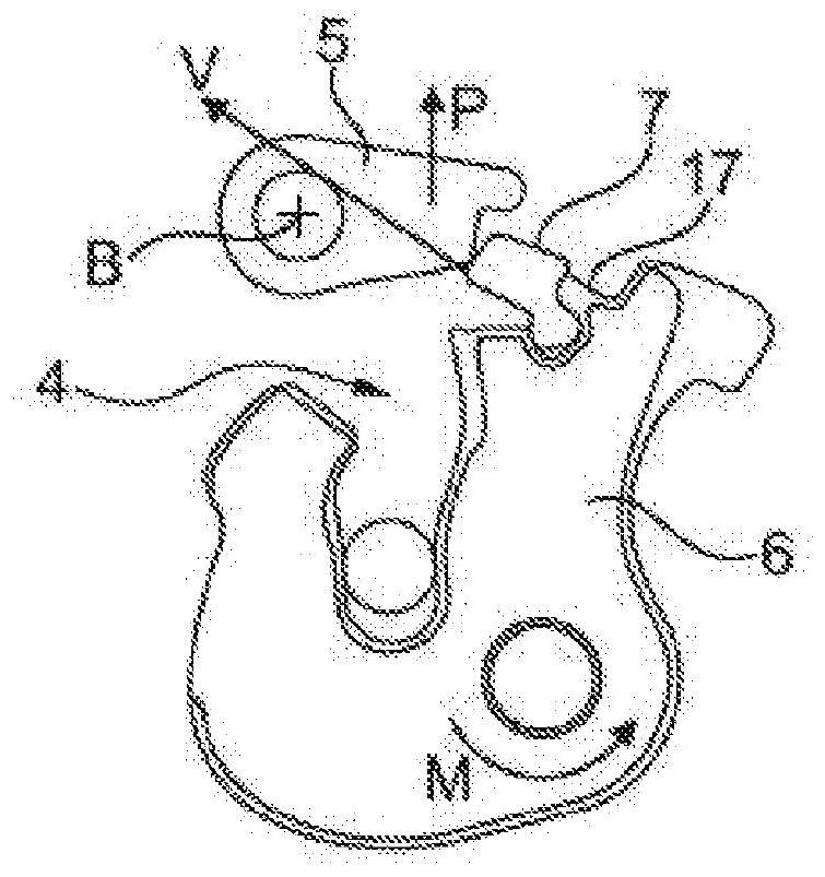 Lock for a motor vehicle, in particular an electrically actuatable motor vehicle lock