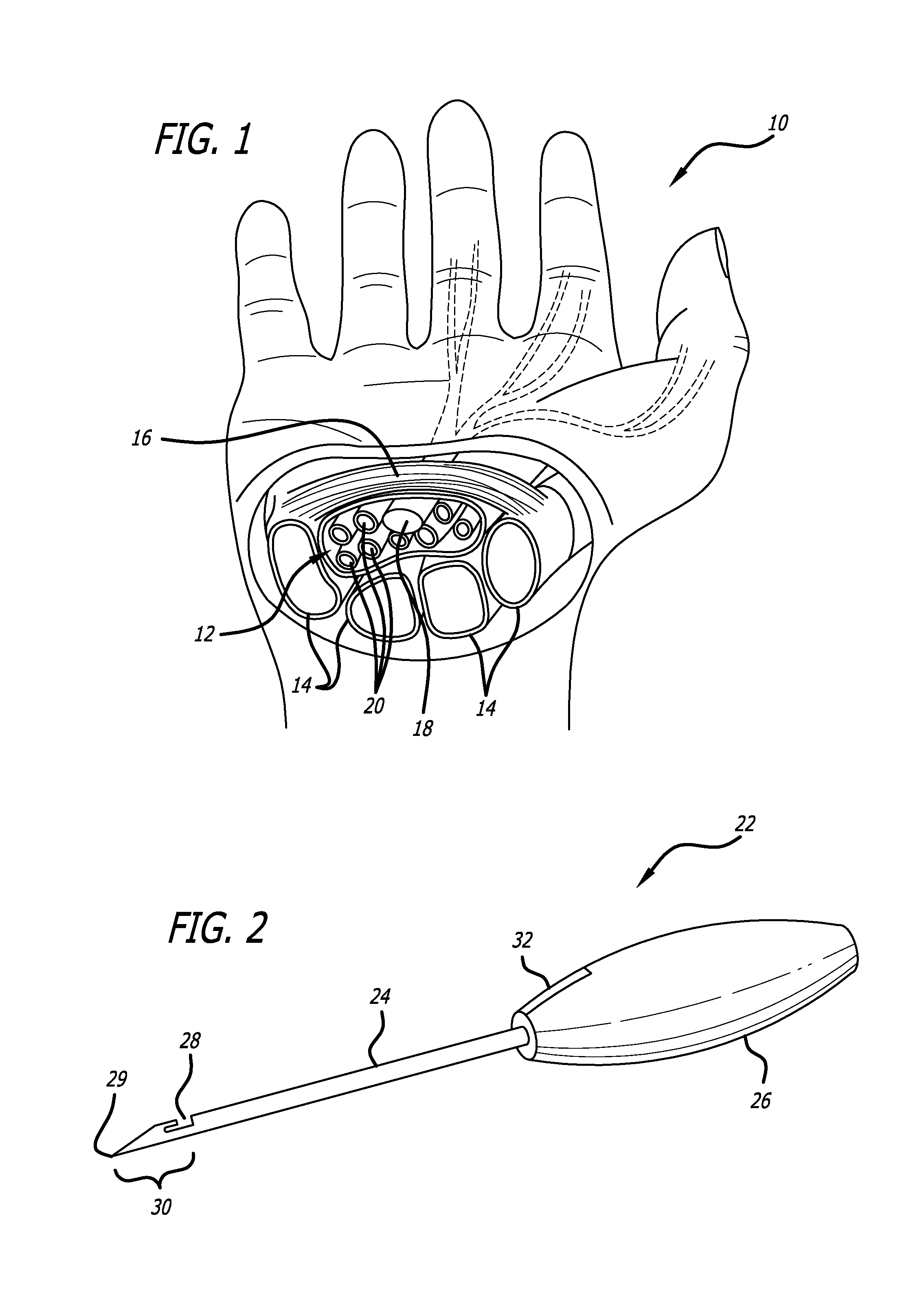 Method and apparatus for thread transection of a ligament