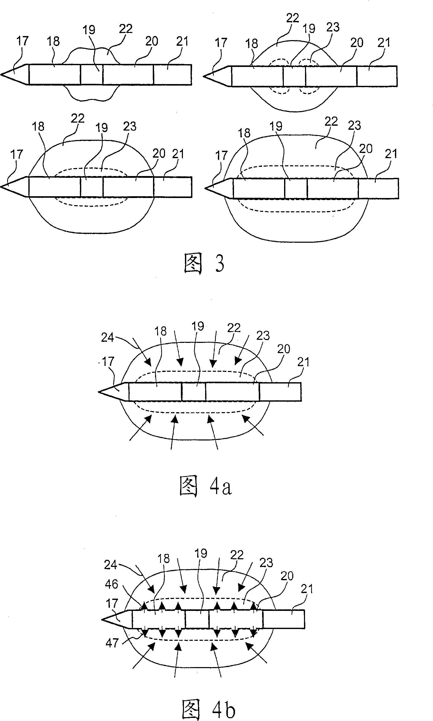 Device for the electro-surgical sclerosing of body tissues