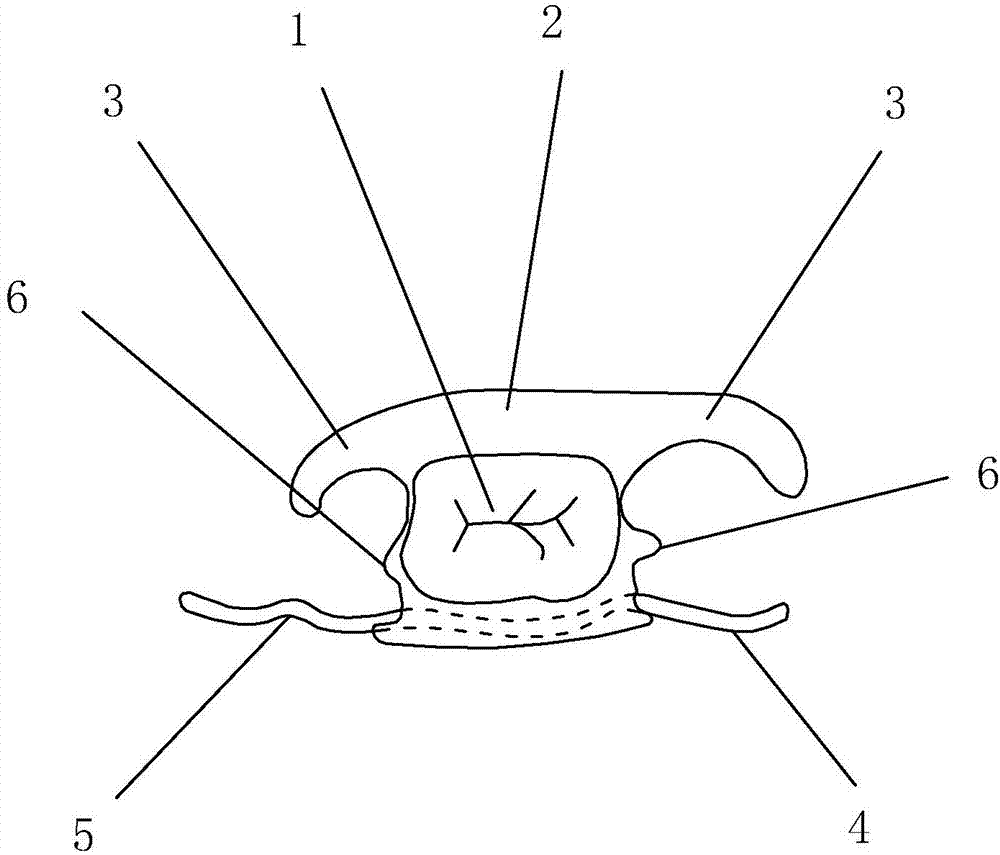 A removable denture and its manufacturing process