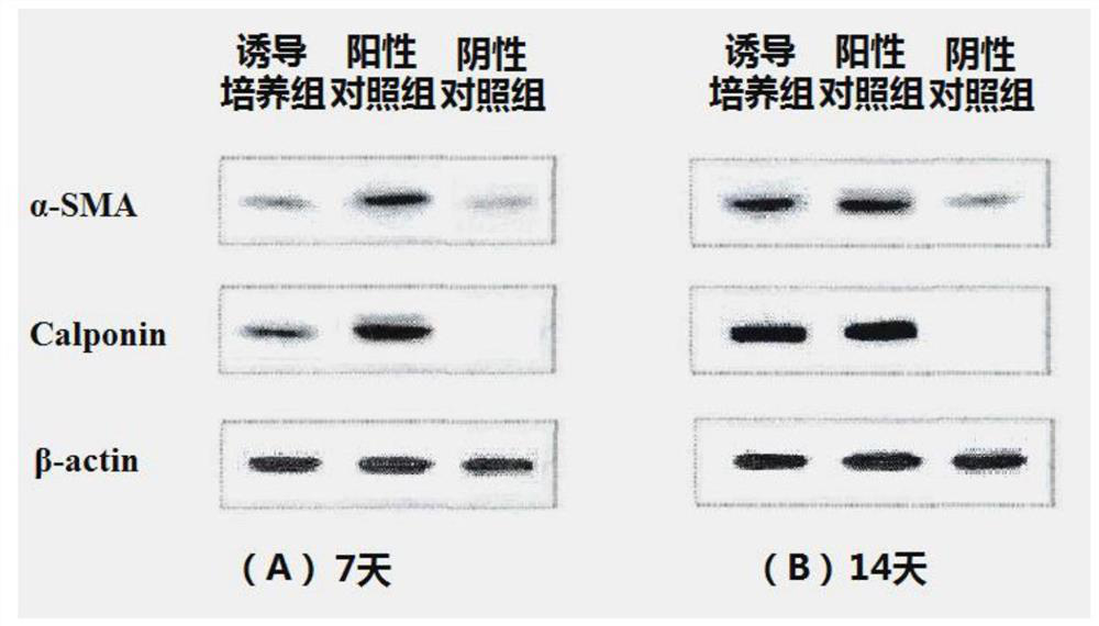 A high-efficiency inducing differentiation agent and inducing differentiation medium for adipose stem cells