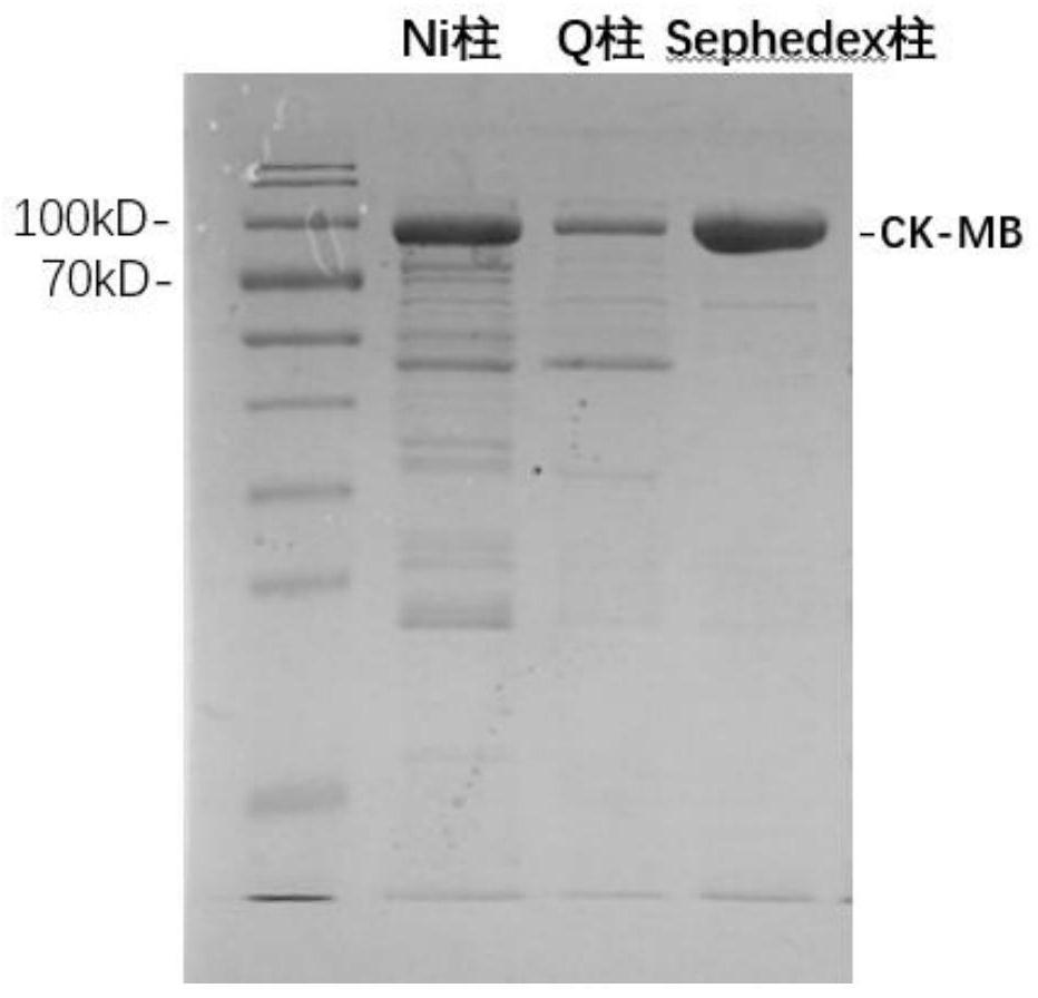 ck-mb fusion protein and its preparation method and detection kit