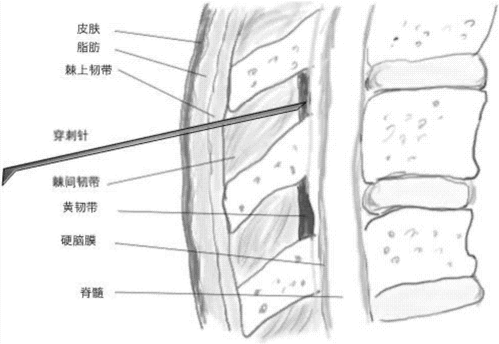 Lumbar puncture virtual simulation and training system supporting force-sense interaction