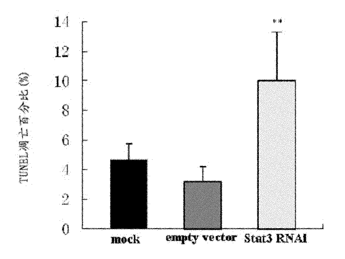 Micro-molecular interference ribonucleic acid (RNA) for inhibiting glioma proliferation and promoting glioma apoptosis as well as preparation method and application thereof