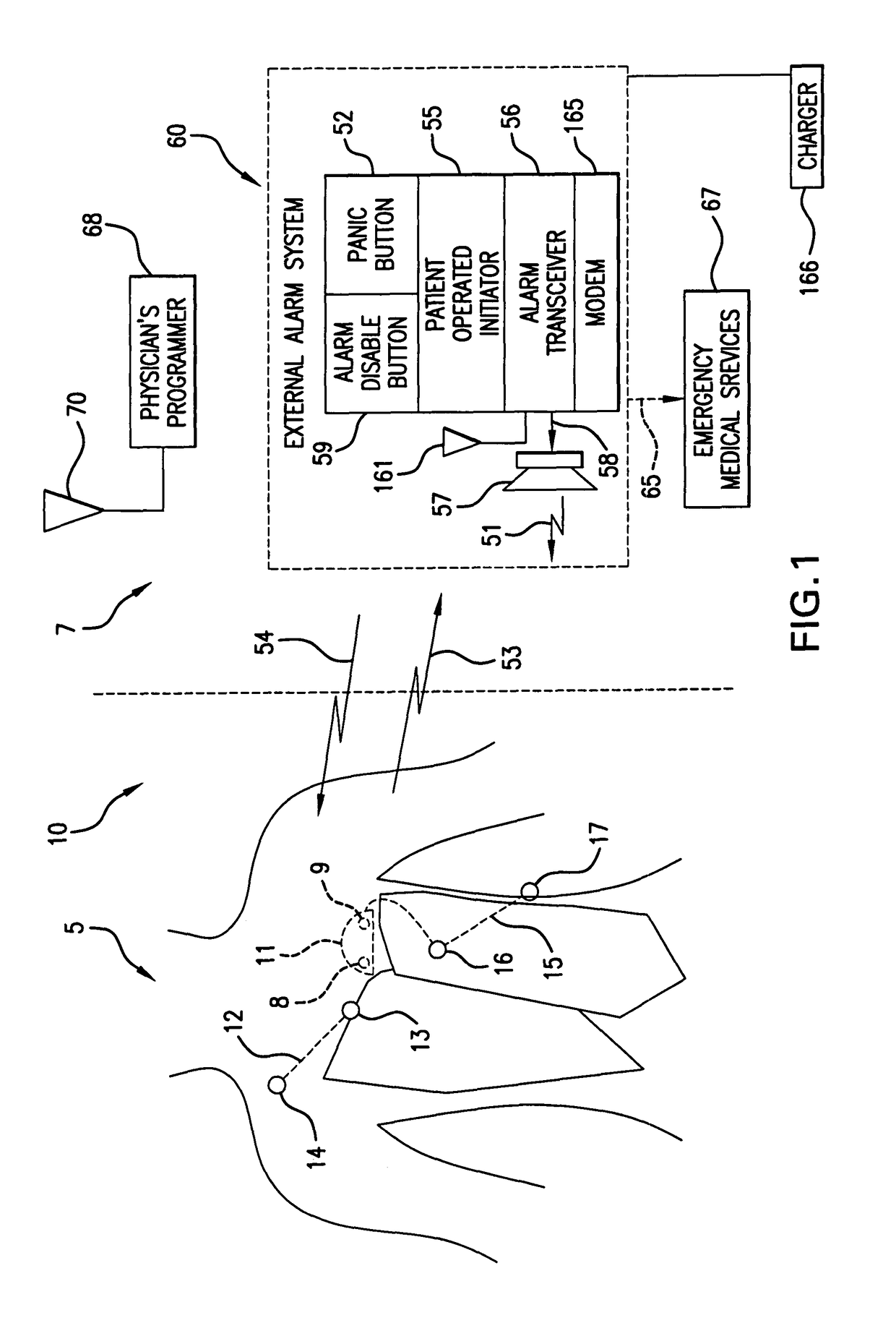 Waveform feature value averaging system and methods for the detection of cardiac events