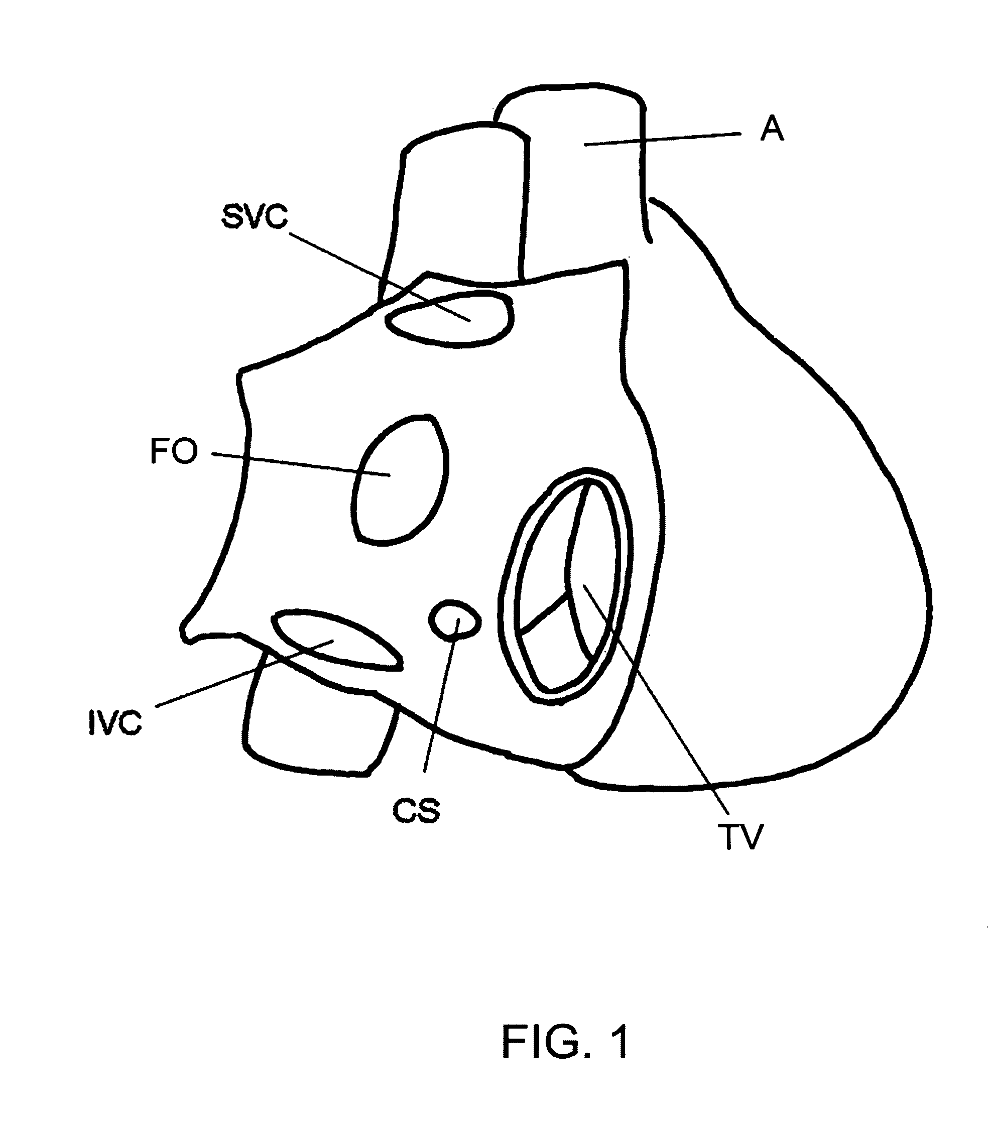 Methods and devices for image-guided manipulation or sensing of anatomic structures