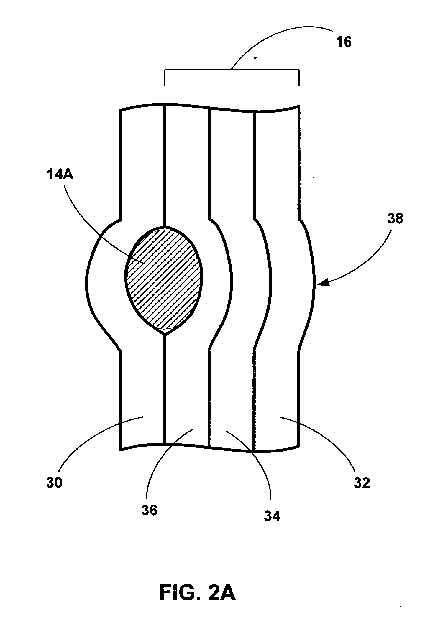 Implantation of tissue bulking devices