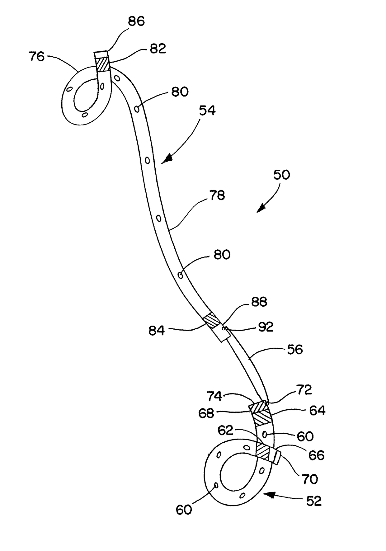 Ureteral stent for placement in a kidney and bladder