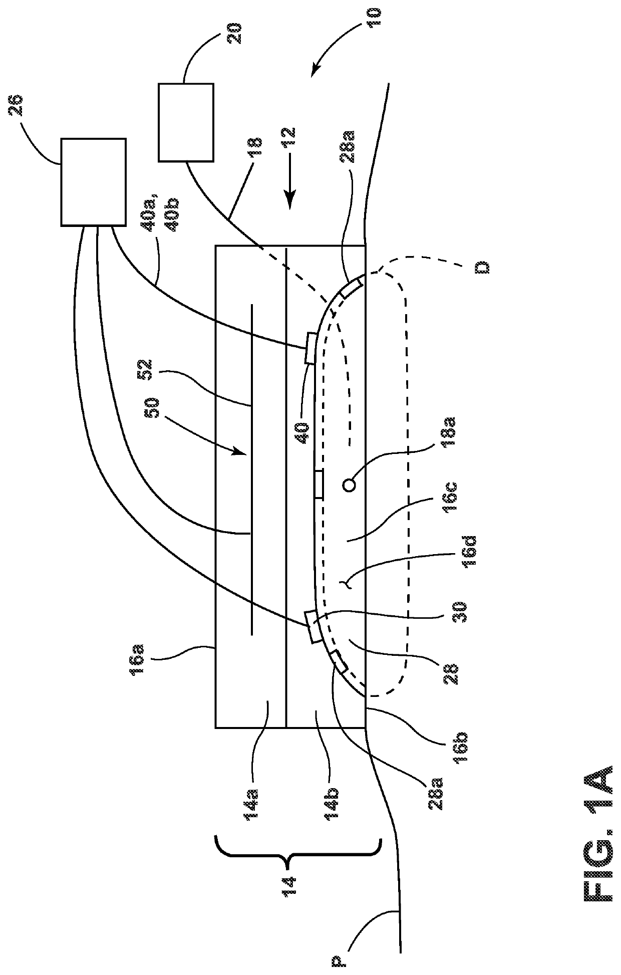 Apparatuses, systems, and methods for the treatment of damaged tissue