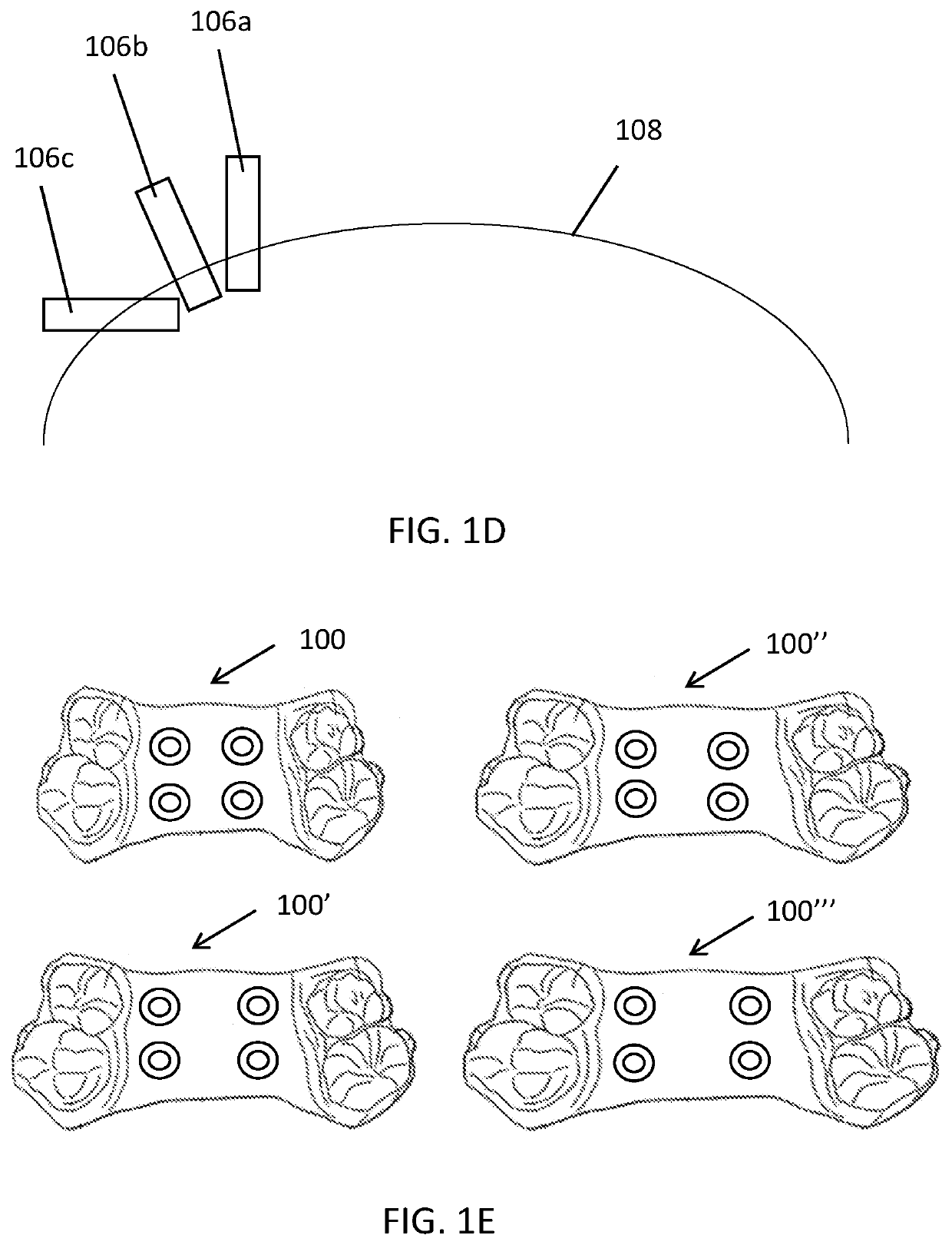 Palatal expander with skeletal anchorage devices