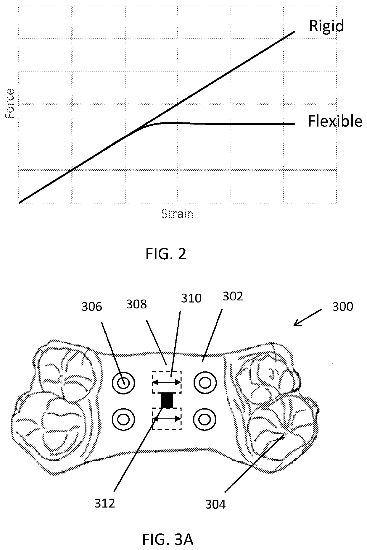 Palatal expander with skeletal anchorage devices