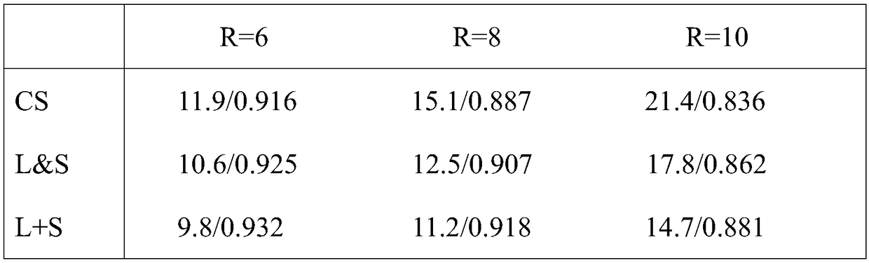 Low-rank and sparse matrix decomposition dynamic magnetic resonance imaging method