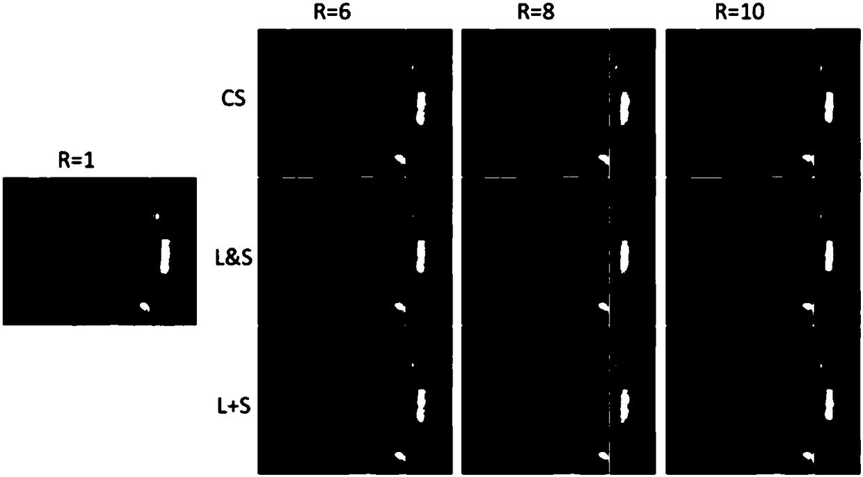 Low-rank and sparse matrix decomposition dynamic magnetic resonance imaging method