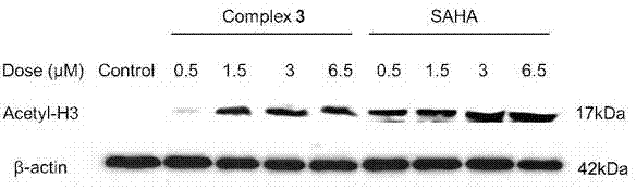 Ruthenium complex and preparation method thereof and purpose of product as histone deacetylase inhibitor