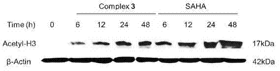 Ruthenium complex and preparation method thereof and purpose of product as histone deacetylase inhibitor