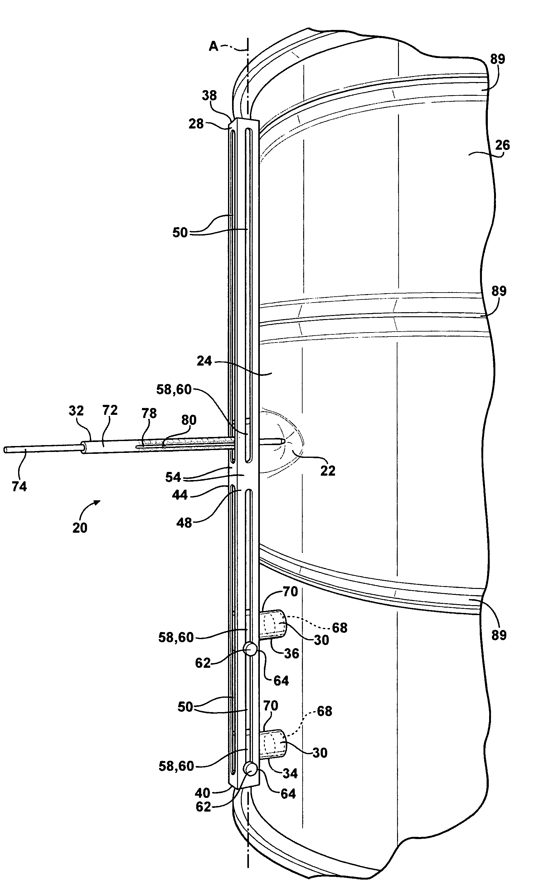 Method of measuring dents and method of classifying dents