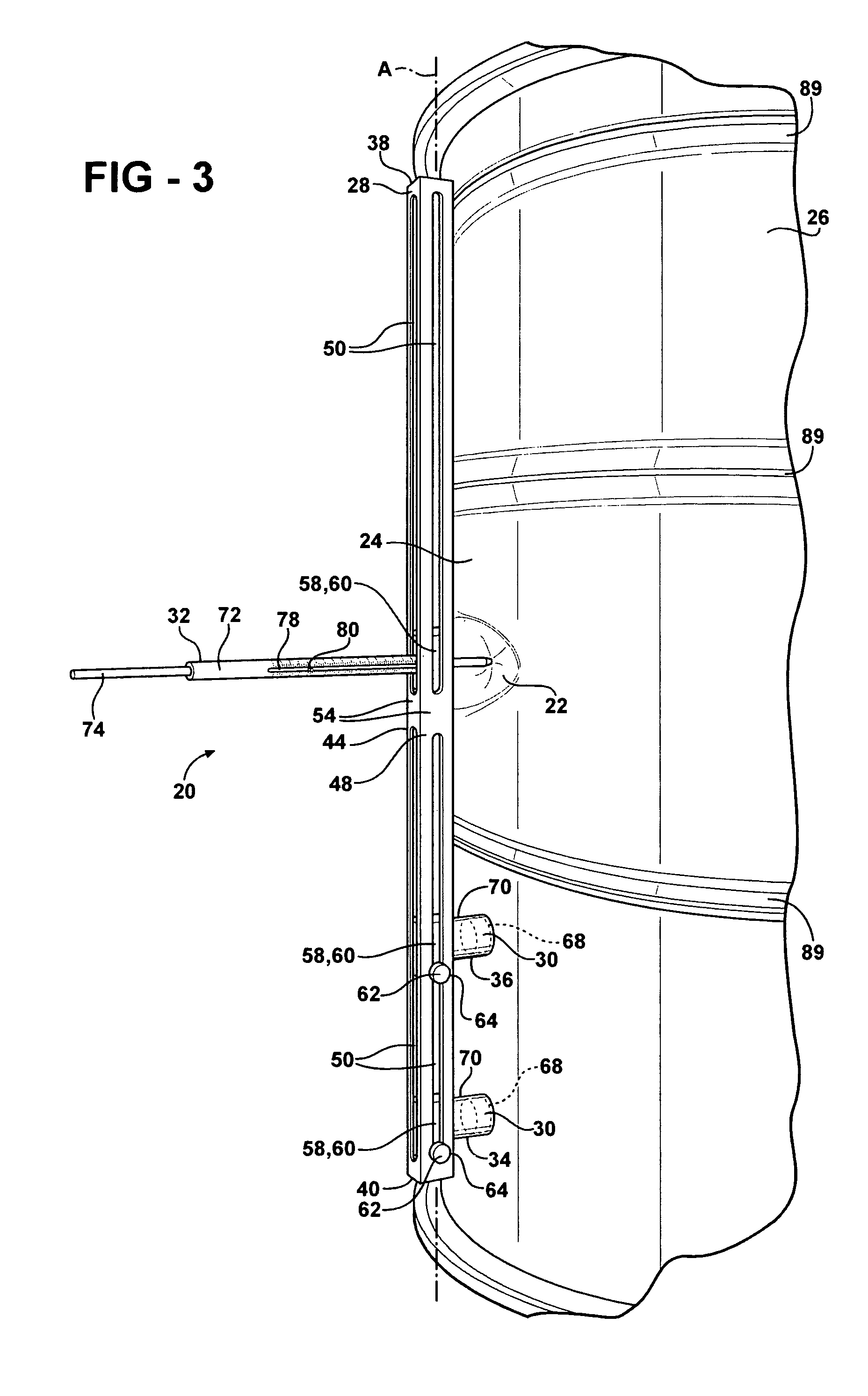 Method of measuring dents and method of classifying dents